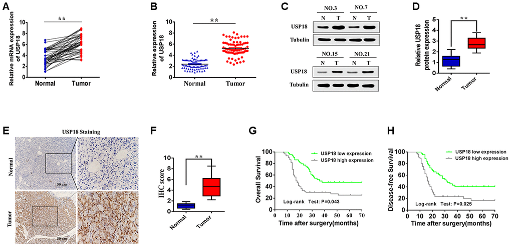Relative USP18 expression in pancreatic cancer and its clinical significance. (A, B) Determination (A) and quantification (B) of USP18 mRNA levels in pancreatic cancer tissues and in paired normal tissues by qRT-PCR analysis. Tubulin was used as a loading control. **pC and D) Relative expression of USP18 in pancreatic cancer tissues and adjacent non-tumour tissues by western blotting analysis. Statistical differences were analysed using the paired t test. **pE and F) Representative images (E) and quantification (F) of USP18 staining in paired pancreatic cancer tissues. Scale bar, 50 μm. (G and H) Relationship between USP18 expression with poor overall survival and disease-free survival in pancreatic cancer patients.