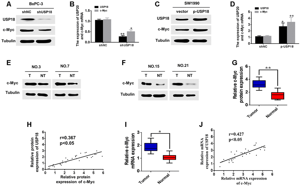 USP18 promotes pancreatic cancer cell growth by upregulating c-Myc expression. (A, B) analyses were performed to detect the USP18 and C-Myc expression levels in BxPC-3 cells transfected with shUSP18 or shNC. (C and D) Western blot and qRT-PCR analyses were performed to detect the USP18 and C-Myc expression levels in SW1990 cells transfected with p-USP18 or vector. (E–G) Determination and quantification of c-Myc protein levels in pancreatic cancer tissues and paired non-tumour tissues by western blotting. Tubulin served as a loading control. (H) Scatter plots of USP18 and c-Myc protein expression in pancreatic cancer. (I) Determination of c-Myc mRNA levels in pancreatic cancer tissues and paired non-tumour tissues by qRT-PCR. (J) Scatter plots of USP18 and c-Myc mRNA expression in pancreatic cancer.