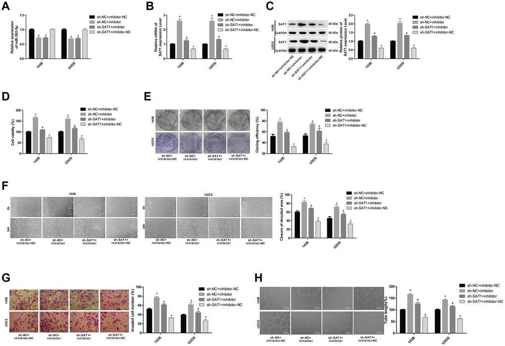 MiR-382-5p targets SAT1 to regulate osteosarcoma cell proliferation, migration, invasion and tube formation. (A) The expression level of miR-382-5p in each group. (B, C) The expression level of SAT1 mRNA and protein in each group. (D, E) CCK-8 and colony formation assays were used to detect cell viability and proliferation. (F, G) Wound healing and Transwell assays were applied to detect cell migration and invasive ability. (H) The tube production capacity of the cells was detected using tube formation assay. *P #P 