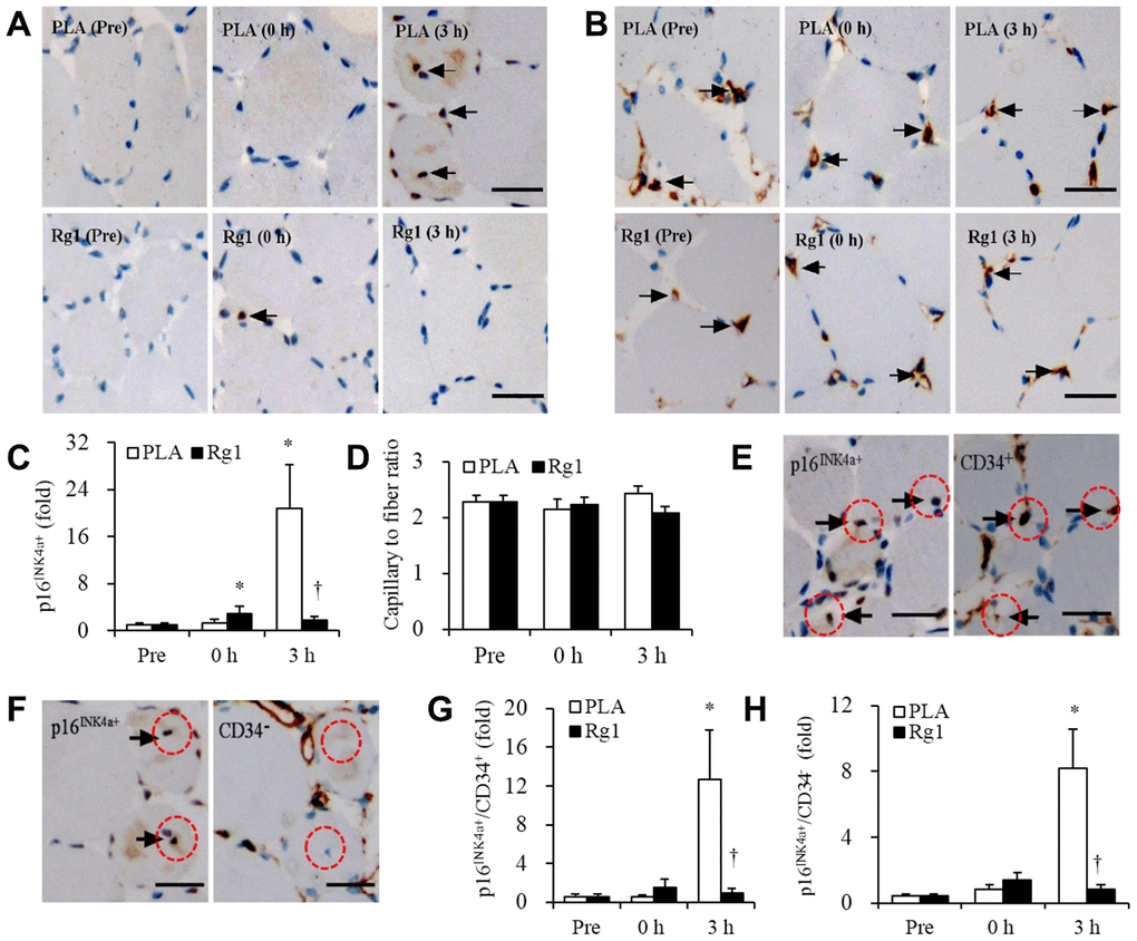 Massive increases of senescent endothelial progenitor cells in human skeletal muscle 3 h after aerobic exercise (70% V̇O2max). Approximately 21-fold increases in senescent endothelial progenitor cells occurred 3 h after 1-h cycling exercise (70% V̇O2max), while Rg1 supplementation advances the increase immediately after exercise (~3-fold) and decline to baseline 3 h after exercise (A, C). Total endothelial progenitor cells (CD34+) surrounding myofibers were unaltered after exercise for both trials (B, D). Approximately 60% of elevated senescent endothelial progenitor cells was contributed by endothelial progenitor cells (p16INK4a+ / CD34+) (E, G), while the rest of 40% was contributed by infiltrated nucleated cells (p16INK4a+ / CD34-) (F, H). Scale bar = 30 μm. Data are expressed as mean and SEM. * Significant difference against Pre (Baseline), P 