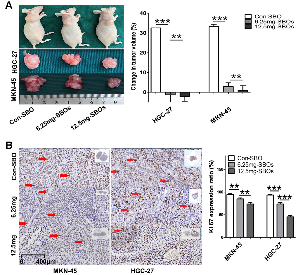Shifted myeloid cell leukemia (Mcl)-1 splicing from Mcl-1L to Mcl-1S suppresses gastric cancer (GC) proliferation in vivo. (A) Change in tumor volume ([end-point volume – initial volume]/initial volume) after treatment with steric-blocking oligonucleotides (SBOs) at indicated dosages is presented. The results of the between-group analyses are shown as the means ± standard deviation. (B) Immunohistochemical staining showing Ki-67 expression levels (red arrows) in tumor sections of the xenograft models, exhibiting changes in tumor viability and proliferation, after treatment with SBOs at indicated dosages is shown.