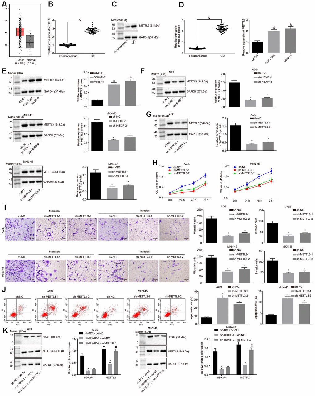 Silencing HBXIP diminishes the expression pattern of METTL3 and inhibits GC cell viability, migration and invasion, and induces apoptosis. (A) Expression pattern of METTL3 in GC as shown in the TCGA database. The left red box diagram represents tumor samples, and the right gray box diagram indicates normal samples. The numbers of tumor samples and normal samples are marked below. (B and C), METTL3 mRNA expression and protein expression patterns in GC and paracancerous tissues were determined by RT-qPCR (B) and Western blot analysis (C), normalized to GAPDH, & p vs. the paracancerous tissues. D and E, METTL3 mRNA expression and protein expression in GC cells were determined by RT-qPCR (D) and Western blot analysis (E), normalized to GAPDH, & p vs. the GES-1 cells. (F) METTL3 protein expression examined by Western blot analysis after silencing HBXIP, normalized to GAPDH. G, METTL3 protein expression examined by Western blot analysis after silencing METTL3, normalized to GAPDH. (H) Viability of AGS and MKN-45 cells examined by CCK-8 assay upon METTL3 silencing. (I) Migration and invasion of AGS and MKN-45 cells were examined by Transwell assay upon METTL3 silencing (× 200). (J) Apoptosis of AGS and MKN-45 cells examined by flow cytometry upon METTL3 silencing. (K) Representative Western blots of METTL3 and HBXIP proteins and their quantitation in AGS and MKN-45 cells upon HBXIP silencing or combined with METTL3 overexpression, normalized to GAPDH.