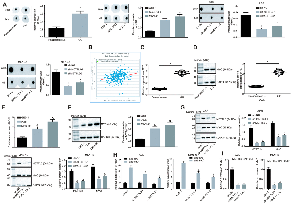 Silencing of METTL3 reduces MYC mRNA m6A modification and impedes the MYC expression pattern in GC cells. (A) m6A modification levels in GC tissues (n = 45) and GC cells were examined by dot blot assays, * p vs. the paracancerous tissues or GES-1 cells. (B) METTL3 and MYC co-expression in GC from the TCGA database. Each point represents a sample, the abscissa indicates the METTL3 expression pattern, the ordinate indicates the MYC expression pattern, and the upper left indicates the correlation coefficient and p value. (C and D), MYC mRNA expression and protein expression patterns in GC and paracancerous tissues (n = 45) were determined by RT-qPCR (C) and Western blot assay (D), normalized to GAPDH, which were expressed as mean ± standard deviation, and test with paired t-test, * p vs. the paracancerous tissues. (E and F) MYC mRNA expression and protein expression patterns in AGS and MKN-45 cells were determined by RT-qPCR (E) and Western blot assay (F), normalized to GAPDH. (G) Representative Western blots of MYC protein and its quantitation in AGS and MKN-45 cells after silencing METTL3, normalized to GAPDH. (H) Me-RIP and RT-qPCR were used to examine m6A levels of MYC mRNA in AGS and MKN-45 cells after silencing METTL3. (I) The binding of METTL3 to MYC mRNA assessed by PAR-CLIP assay in GC cells following METTL3 silencing. The above results were measurement data, and expressed as mean ± standard deviation. Data in panels A (the left), (C and D) were compared by paired t test, and in panels A (the middle and the right) and (E–I) by one-way ANOVA with Tukey’s post hoc test. The cell experiment was repeated 3 times independently.