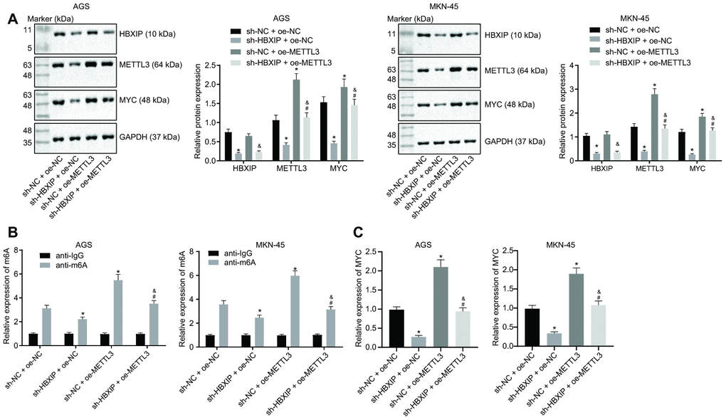 Silencing HBXIP impairs METTL3-mediated MYC m6A mRNA modification in vitro. (A) Representative Western blots of HBXIP, METTL3 and MYC proteins and their quantitation in AGS and MKN-45 cells treated with sh-HBXIP, oe-METTL3 or both, normalized to GAPDH. (B) m6A levels of MYC mRNA were examined by Me-RIP and RT-qPCR in AGS and MKN-45 cells treated with sh-HBXIP, oe-METTL3 or both. (C) The binding of METTL3 to MYC mRNA assessed by PAR-CLIP assay in GC cells treated with sh-HBXIP, oe-METTL3 or both. * p vs. the sh-NC and oe-METTL3 group (AGS or MKN-45 cells treated with sh-NC and oe-NC, # p vs. the sh-HBXIP + oe-NC group (AGS or MKN-45 cells treated with sh-HBXIP and oe-NC), & p vs. the sh-NC + oe-METTL3 group (AGS or MKN-45 cells treated with sh-NC and oe-METTL3). The above results were measurement data, and expressed as mean ± standard deviation, and compared using one-way ANOVA with Tukey’s post hoc test. The cell experiment was repeated 3 times independently.