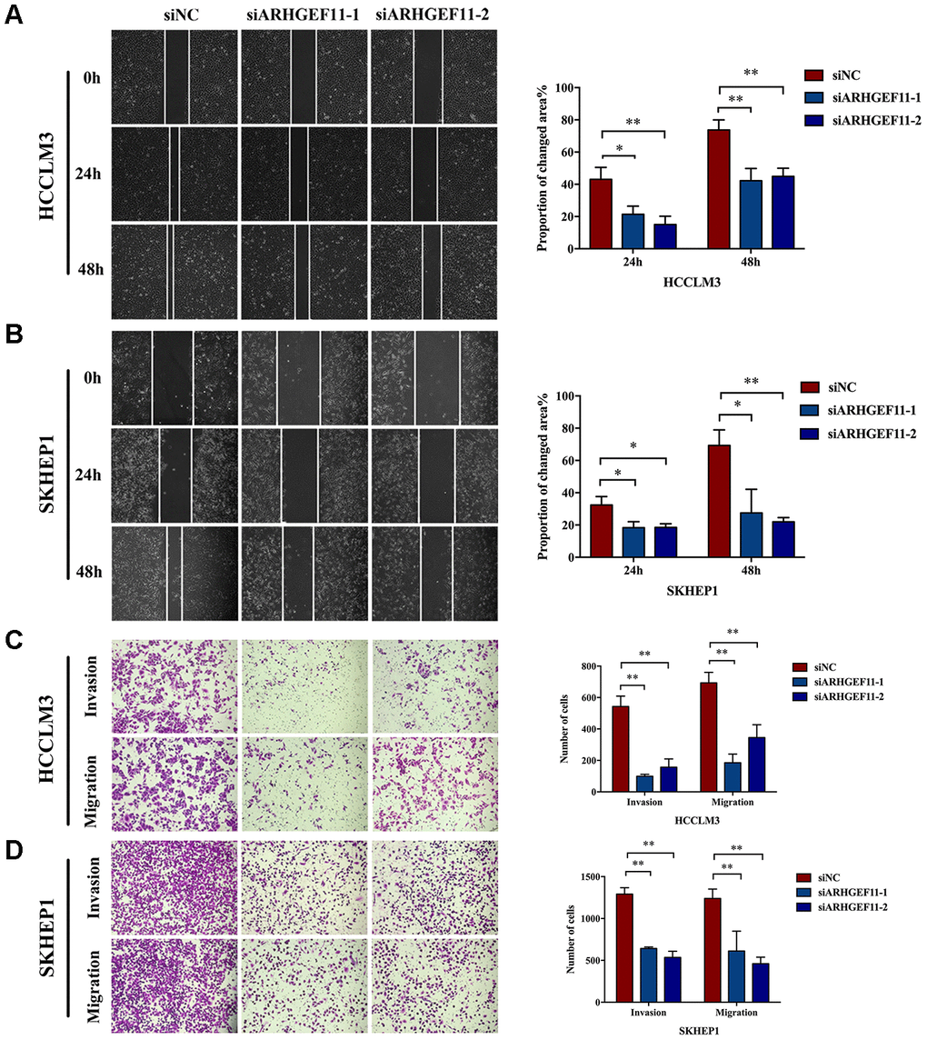 Knockdown of ARHGEF11 suppresses the migration and invasion of hepatoma cells. (A and B) Migration ability examined by Wound healing assay. The representative images (left) and proportion of changed area (right) are shown. (C and D) The migration and matrigel invasion ability detected by Transwell assay. The representative images (left) and average cell number on the bottom membrane (right) are shown. Data are presented as mean ± SD. *PP