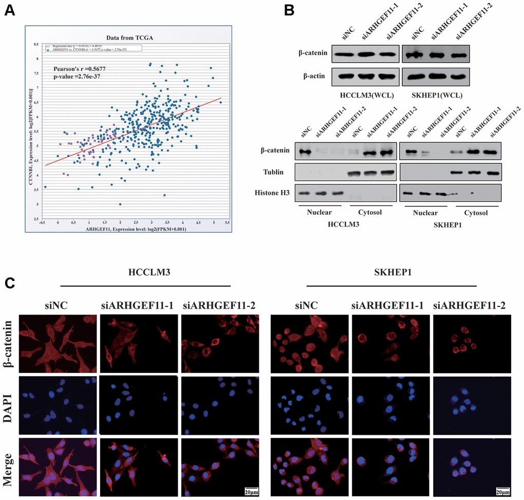 Knockdown of ARHGEF11 attenuates EMT, cell cycle progression and induces cell apoptosis via β-catenin-dependent way. (A) Correlation between the β-catenin and ARHGEF11 expression from TCGA HCC dataset analyzed by online CHIPbase. (B) β-Catenin expression from whole-cell lysates (up panel), the cytoplasmic and cell nuclear lysates (below panel) detected by western blot. (C) β-Catenin expression determined via immunofluorescence.