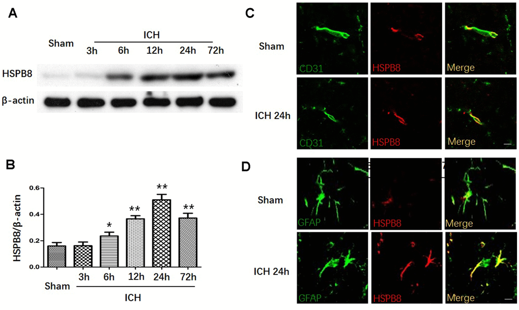 HSPB8 expression was increased upon ICH. (A) Representative western blot bands for HSPB8 expression in sham and ICH rats 3, 6, 12, 24, and 72 h following ICH. (B) Densitometric quantification of HSPB8 for the western blot (n=6, mean±SEM). (C) Representative images of immunofluorescence staining for HSPB8 and CD31 in control and ICH (D) Representative images of immunofluorescence staining for HSPB8 and GFAP in control and ICH. Scale bars = 50 μm (n =4, mean±SEM). *P 