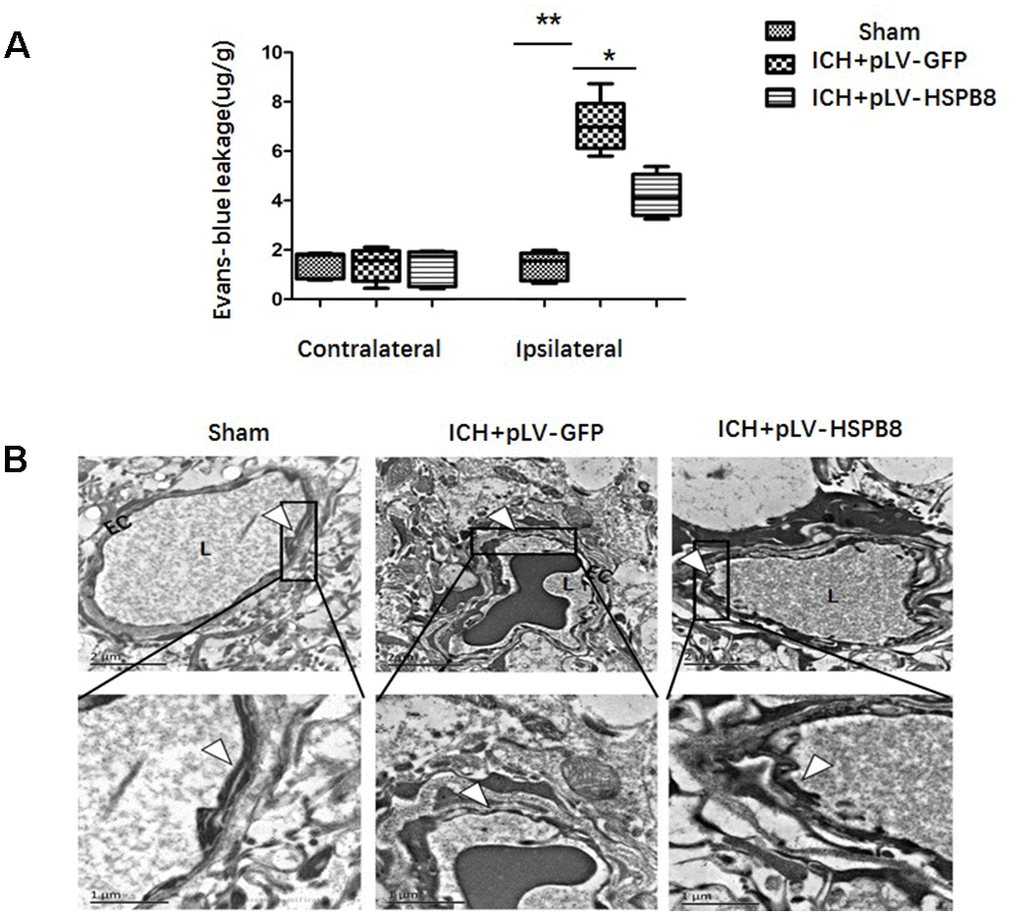 HSPB8 overexpression inhibited ICH-induced BBB destruction. (A) Quantitative analysis of Evans blue extravasation at 24h after ICH (n=5, mean±SEM). (B) TEM images of the morphometric changes of BBB (n=5, mean±SEM). EC: endothelial cell; L: lumina. Arrowheads show TJ. **P 