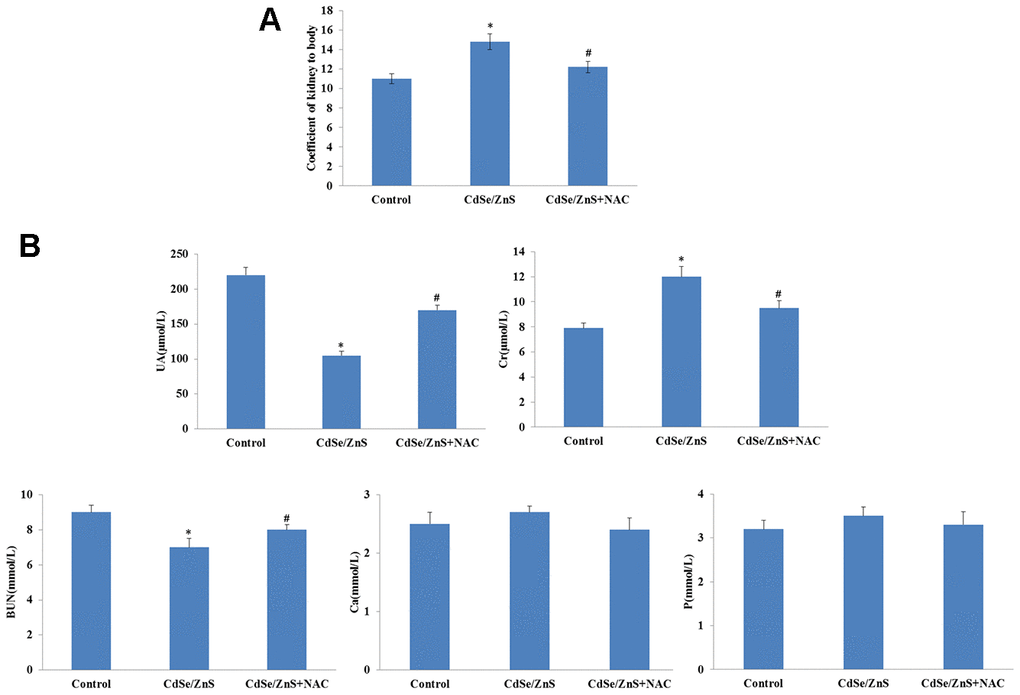 CdSe/ZnS QDs caused kidney disorder in mice. (A) The kidney weight coefficient of mice after CdSe/ZnS QDs and/or N-acetylcysteine (NAC, antioxidant) injection. (B) Measurements of biochemical indicators of renal function, including uric acid (UA), urea nitrogen (BUN), creatine (Cr), calcium (Ca) and phosphorus (P), using clinical automatic chemistry analyzer. *P #P 