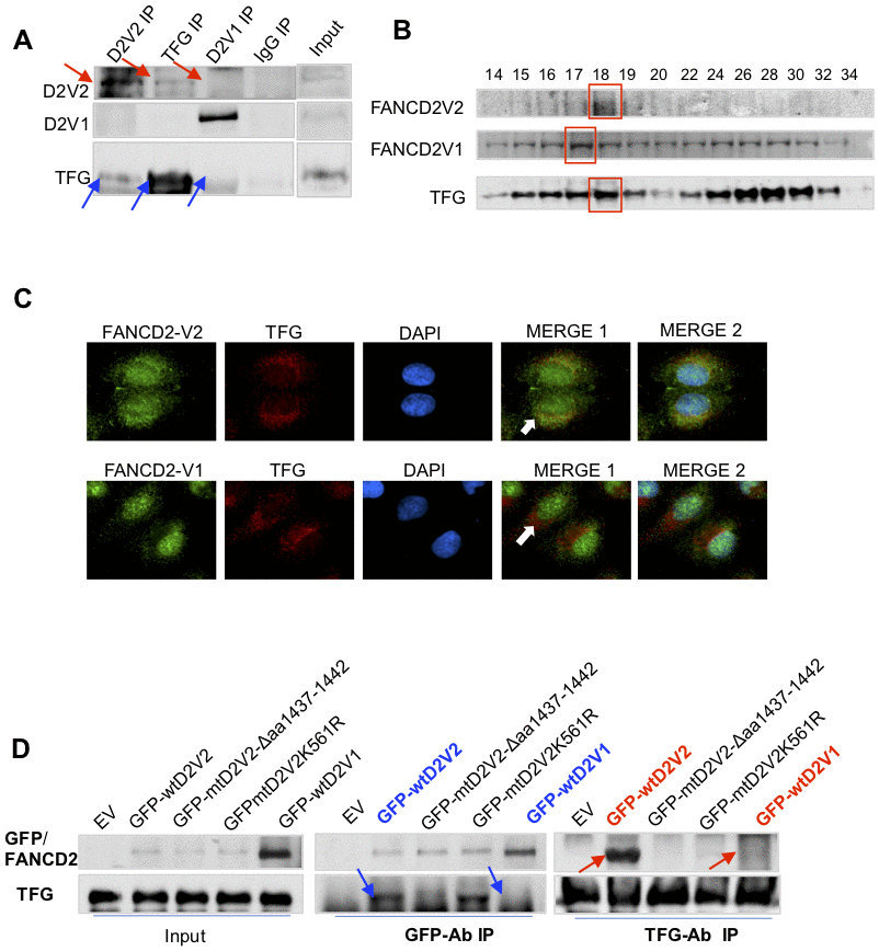TFG interacts with FANCD2-V2, but not FANCD2-V1. (A) TFG interacts with the endogenous FANCD2-V2, but not FANCD2-V1. Reverse immunoprecipitation (IP) and western blotting (WB) of endogenous FANCD2-V2, FANCD2-V1 and TFG Rabbit IgG were performed using lysates prepared from U2OS cells. TFG signaling can be clearly detected in the pulldown by antibodies recognizing FANCD2-V2 but not FANCD2-V1. (B) TFG is co-peaked with FANCD2-V2 but not with FANCD2-V1. Gel filtration was performed using the total cell lysates prepared from U2OS cells. Western blotting of FANCD2-V1, -V2 or TFG showed that TFG and FANCD2-V2 were peaked at the same fraction, but FANCD2-V1’s peak was a fraction late. (C) Fluorescent co-localization of TFG with FANCD2-V2, not with FANCD2-V1. Immunofluorescent study was performed on normally growing U2OS cells. The fixed cells were primarily blocked with antibodies targeting FANCD2-V2, FANCD2-V1, or TFG. Subsequently, anti-Rabbit-Alexa 488 and anti-mouse-Alexa 568 were applied (DAPI was used for nuclear staining. Green fluorescence of FANCD2-V2, but not FANCD2-V1, can be merged with the red florescence of TFG (the orange color). The association of TFG with FANCD2-V2 was also supported by Pearson’s or Mander’s colocalization coefficient with an R nearly 1 (0.96 or 0.98). (D) The association of FANCD2-V2 with TFG is attributed to its unique carboxyl terminal. HEK293T cells were transfected with empty vectors, GFP-wtFANCD2-V2, GFP-mtFANCD2-V2Δaa1437-1442, GFP-mtFANCD2 K561R or GFP-wtFANCD2-V1. Antibodies targeting GFP or endogenous TFG were used for reverse IP and WB. TFG can pull down GFP-wtFANCD2-V2, point mutant of FANCD2-V2K561R, but not the carboxyl terminal deletion mutant of FANCD2-V2, either GFP-wtFANCD2-V1 (IgG negative control was performed simultaneously-Supplementary Figure 2D).