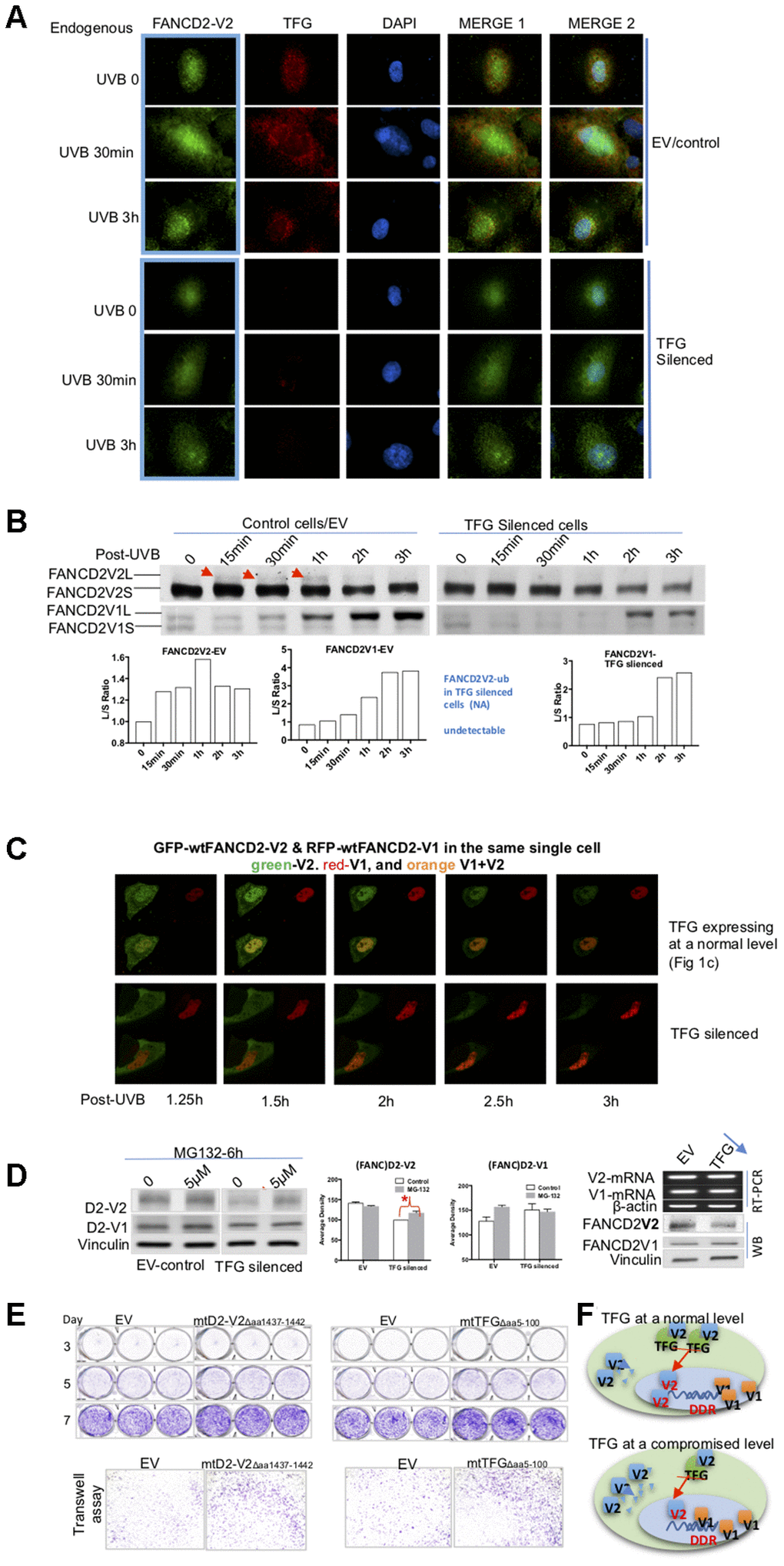 TFG assists biologic properties of FANCD2-V2 through maintaining its protein steady-state level. (A) TFG maintains the earlier peak concentration of FANCD2-V2 in the stressed cells. Both empty vector control and TFG compromised cells were fixed post UVB treatment for 30min, 3h or untreated for 0 min. Anti-FANCD2-V2 and anti-TFG antibodies were used for primary incubation; and anti-Rabbit-Alexa 488 and anti-mouse-Alexa 568 were used for detection of green (FANCD2-V2) and red (TFG) fluorescence respectively. Green fluorescent intensity is lower in TFG-compromised cells (dim red fluorescence) compared to the cells expressing a normal level of TFG (bright red). Blue fluorescence (DAPI) indicates the nucleus of each individual cell. (B) Compromised expression of TFG interferes the peak level of activated FANCD2-V2, but not FANCD2-V1. Nuclear extracts of empty vector control and TFG-silenced cells were analyzed by western blot after UVB treatment (25J/m2). Both endogenous FANCD2-V2 and FANCD2-V1 were detected with each specific antibody. The peak level of activated FANCD2-V2 was undetectable or postponed in TFG-expression compromised cells, but not FANCD2-V1 (indicated by red arrowheads and the relative ratio graphs). (C) Live images were taken on control and TFG-silenced cells co-transfected with GFP-FANCD2-V2 and RFP-FANCD2-V1, and photos were taken in a 30min interval. Green fluorescent intensity (FANCD2-V2 protein) was low and spread mainly in cytoplasm of TFG-silenced cells comparing to the control cells carrying a normal level of TFG expression. But there is not much difference for RFP-FANCD2-V1 (red fluorescent intensity) between two types of cells (Supplementary Videos 1 and 6). The fluorescence changes were similarly shown in relatively-elevated fluorescence (Supplementary Figure 4D). (D) TFG protects FANCD2-V2 from the proteasome-mediated degradation. EV control or TFG silenced cells were treated with 5μM MG132 for 6h. The corresponding whole cell lysates were analyzed by antibodies targeting FANCD2-V2 and FANCD2-V1 respectively. The protein levels of FANCD2-V2 were substantially elevated while blocking proteasome function (MG132 treatment), comparing to FANCD2-V1. Further, TFG modulation of FANCD2-V2 expression does not involve FANCD2-V2 transcription. Both mRNA levels of FANCD2-V1 or V2 are similar between cells carrying a normal or silenced level of TFG expression (through RT-PCR). (E) mtTFGΔaa5-100 or mtFANCD2-V2Δaa1437-1442 elevates cell oncogenicity. Trans-well and cell proliferation were performed using cells expressing mtTFG or mtFANCD2. Cells carrying mtTFGΔaa5-100 or mtFANCD2-V2Δaa1437-1442 both showed a similar level of elevation in cell proliferation and cell migration. Statistical calculations were shown in Supplementary Figure 4C. (F) Working hypothesis of TFG contributions to early DDR delivered by FANCD2-V2. In cells carrying a normal level of TFG expression, FANCD2-V2 responds to genotoxic stresses earlier than FANCD2-V1 (closer to DNA in drawing). However, in cells carrying a compromised level of TFG expression, a less amount of FANCD2-V2 goes into the nucleus owing to a relatively higher amount of FANCD2-V2 undergoing degradation