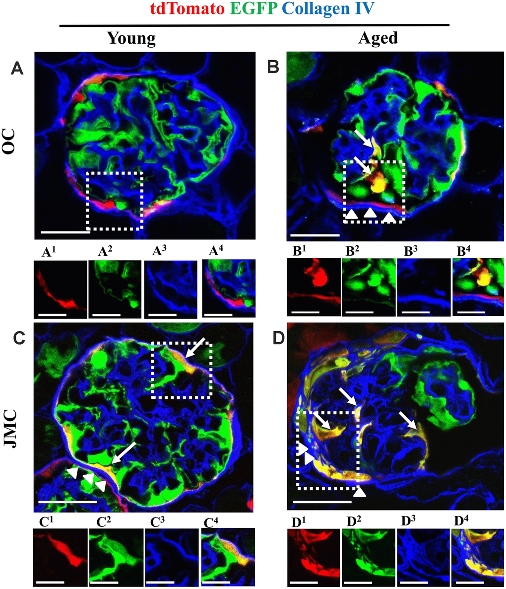 Collagen IV staining increases along Bowman's capsule with accompanied migration of tdTomato+PECs in aged mice. (A–D) Representative confocal images of tdTomato+ (red), EGFP+ (green) and Collagen IV staining (blue) in young and aged mice. The inserts show separate channels of the outlined glomeruli, with superscripts: 1=tdTomato, 2=EGFP, 3=Collagen IV and 4=merged. (A) Young mice (OC) showed that tdTomato+PECs are limited to Bowman’s capsule (A1) and EGFP+ podocytes to the glomerular tuft (A2). Collagen IV staining (blue) (A3) was used to delineate the kidney architecture. (B) Aged mice (OC) showed that differentiated yellow cells (tdTomato+PECs+ EGFP+) (marked with white arrows) were detected in the glomerular tuft (B1, B2) which was accompanied by an increase in Collagen IV staining along BC (white arrow heads) (B3). (C) Young mice (JMC) showed that differentiated yellow cells (tdTomato+PECs+ EGFP+) were detected in some glomeruli along Bowman’s capsule (C1, C2) which was accompanied by an increase in Collagen IV staining along BC (white arrow heads) (C3). (D) Aged mice (JMC) showed that differentiated yellow cells (tdTomato+PECs+ EGFP+) have migrated to the glomerular tuft (marked with white arrows) and co-express tdTomato (D1), EGFP (D2), which was accompanied by an increase in Collagen IV staining along BC (white arrow heads) (D3). Scale bars represent 25μm or 5μm (insets).