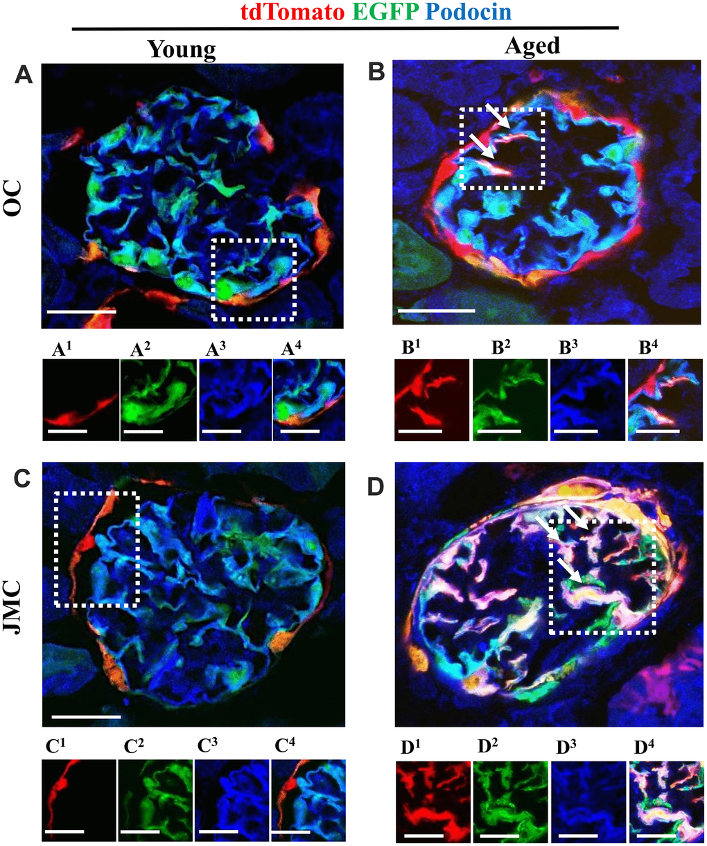 A subset of newly generated podocytes (tdTomato+EGFP+) from PEC origin co-express podocin in the glomerular tuft of aged mice. (A–D) Representative confocal images of tdTomato+ (red), EGFP+ (green) and podocin staining (blue) in young and aged mice. The inserts show separate channels of the outlined glomeruli, with superscripts: 1=tdTomato, 2=EGFP, 3=podocin and 4=merged. Podocin staining was detected with an antibody, tdTomato and EGFP reporters were detected without antibody. (A) Young mice (OC) showed that tdTomato+PECs (red) are detected along Bowman’s capsule (A1). The majority of EGFP+ cells (green) (A2) co-localize with podocin (blue) (A3) and create a cyan color (A4). (B) Aged mice (OC) showed that a subset of differentiated tdTomato+ PECs (red) (B1) co-expresses EGFP+ (green) (B2) and podocin (blue) (B3) creating a pink/white color in the glomerular tuft (white arrows) (B4). (C) Young mice (JMC) showed that tdTomato+PECs (red) (C1) are detected along Bowman’s capsule. The majority of EGFP+ cells (green) (C2) co-localize with podocin (blue) (C3) in the glomerular tuft creating a cyan color (C4). (D) Aged mice (JMC) showed that a higher number of tdTomato+PECs (red) (D1) have migrated to the glomerular tuft (marked with white arrows), become EGFP+ (D2) and co-localized with podocin (blue) (D3), creating a pink/white color (D4). Scale bars represent 25μm or 5μm (insets).