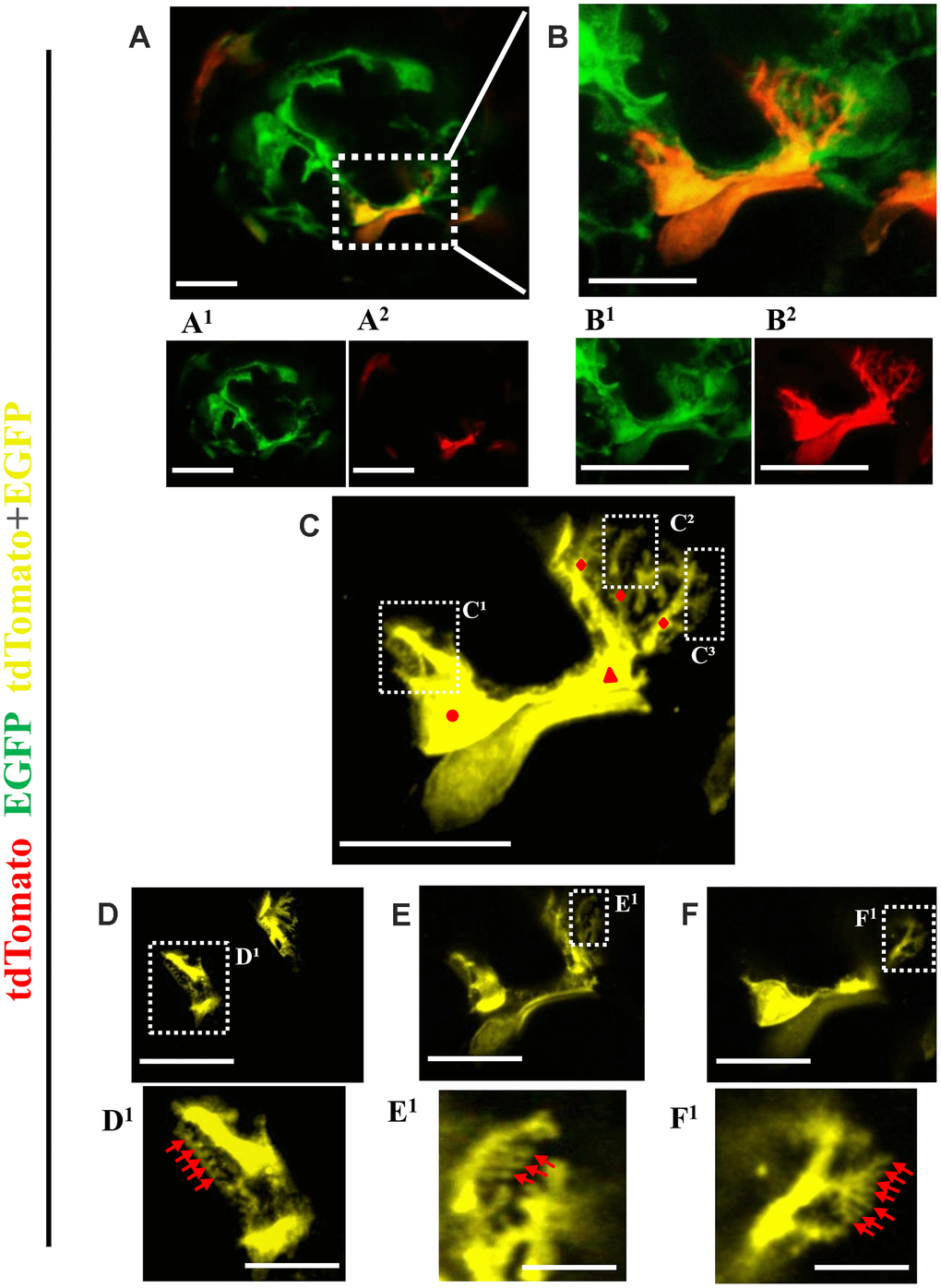 Ultrastructure of newly generated podocytes from PEC origin (tdTomato+EGFP+) in the glomerular tuft of aged mice. (A) Representative confocal image of expansion microscopy of a glomerulus in an aged mouse with a newly generated podocyte from PEC origin (marked with dashed box). Superscripts show separate channels: tdTomato+ (red) (A1) and EGFP+ (A2). (B) Higher magnification of image shown in A of newly generated podocyte, with accompanied single color images of tdTomato (B1) and EGFP (B2). (C) The newly generated podocyte has classic podocyte architecture: a cell body (labeled with red circle), primary process (red triangle), several secondary processes (red rhombuses), branching to minor and tertiary foot processes (C1–C3 labeled with dashed boxes). (D–F) Higher magnification of images shown in dashed boxes C1–C3 with different z-stack focal planes show various tertiary foot processes (labeled with red arrows). Scale bars represent 25μm or 5 μm (inset) and are in pre-expansion dimensions.