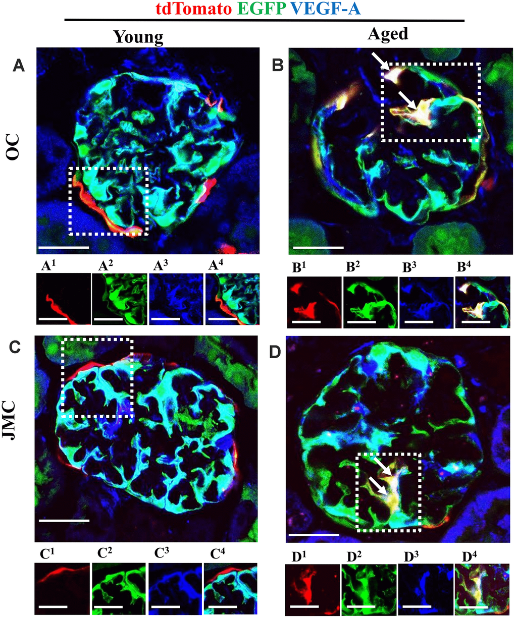 A subset of newly generated podocytes from PEC origin (tdTomato+EGFP+) de novo express VEGF-A in the glomerular tuft of aged mice. (A–D) Representative confocal images of tdTomato+ (red), EGFP+ (green) and VEGF-A (blue, podocyte specific marker) in young and aged mice. The inserts show separate channels of the outlined glomeruli, with superscripts: 1=tdTomato, 2=EGFP, 3=VEGF-A and 4=merged. (A) Young mice (OC) showed that tdTomato+PECs were observed along Bowman’s capsule (A1). EGFP reporter (A2) overlaps with VEGF-A staining (A3) and creates a cyan color (A4). (B) Aged mice (OC) showed that a subset of differentiated tdTomato+ PECs (red) (B1) co-expresses EGFP+ (green) (B2) and VEGF-A (blue) (B3) creating a yellow/white color in the glomerular tuft (white arrows) (B4). (C) Young mice (JMC) showed that tdTomato+ staining PECs were observed along Bowman’s capsule (C1) EGFP staining (C2) was detected in a typical podocyte distribution and overlaps with VEGF-A staining (C3), creating a cyan color (C4). (D) Aged mice (JMC) showed that tdTomato+ staining PECs (D1) (marked with white arrows) have migrated onto the glomerular tuft and differentiated to a podocyte fate, co-staining with EGFP (green) (D2) and VEGF-A (blue) (D3) creating pink/yellow color (D4). Scale bars represent 25μm or 5μm (insets).