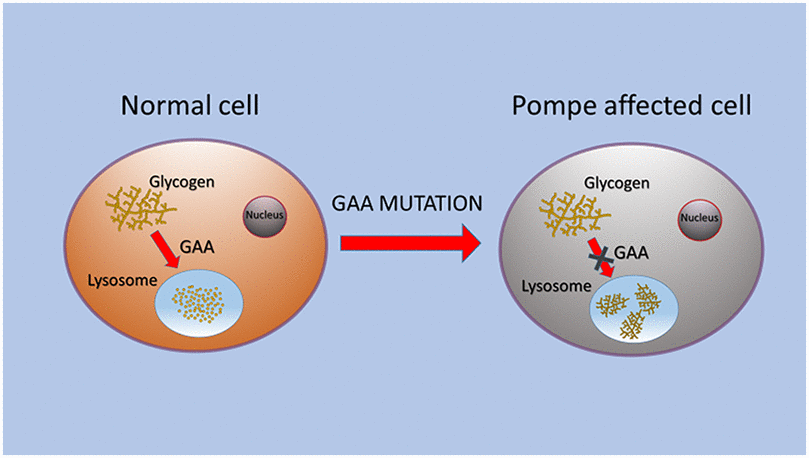 The pathogenesis of Niemann–Pick type C disease: a role for autophagy?, Expert Reviews in Molecular Medicine