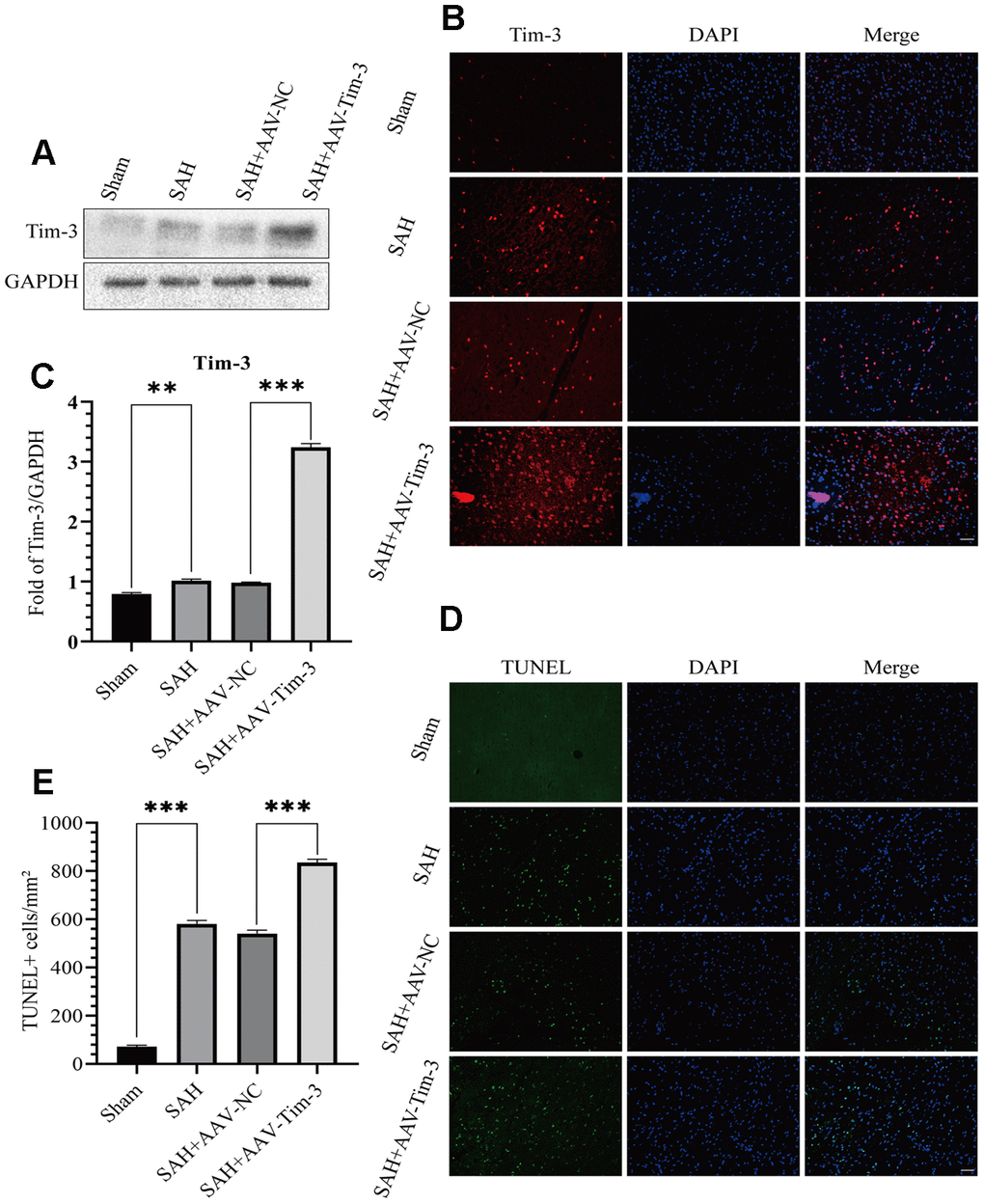 Effects of AAV-Tim-3 treatment on Tim-3 protein levels and neurocyte apoptosis after SAH. Western blotting shows that AAV-Tim-3 significantly increased Tim-3 expression (A) and quantitative analysis of Tim-3 (B). Immunofluorescence staining also verified that AAV-Tim-3 significantly increased Tim-3 expression (C). Representative TUNEL staining images (D) and quantitative analysis of TUNEL-positive cells (E) in the ipsilateral cortex after SAH with AAV-Tim-3 or AAV-NC treatments; n = 6 in each group. Data are expressed as mean ± SD. **p 