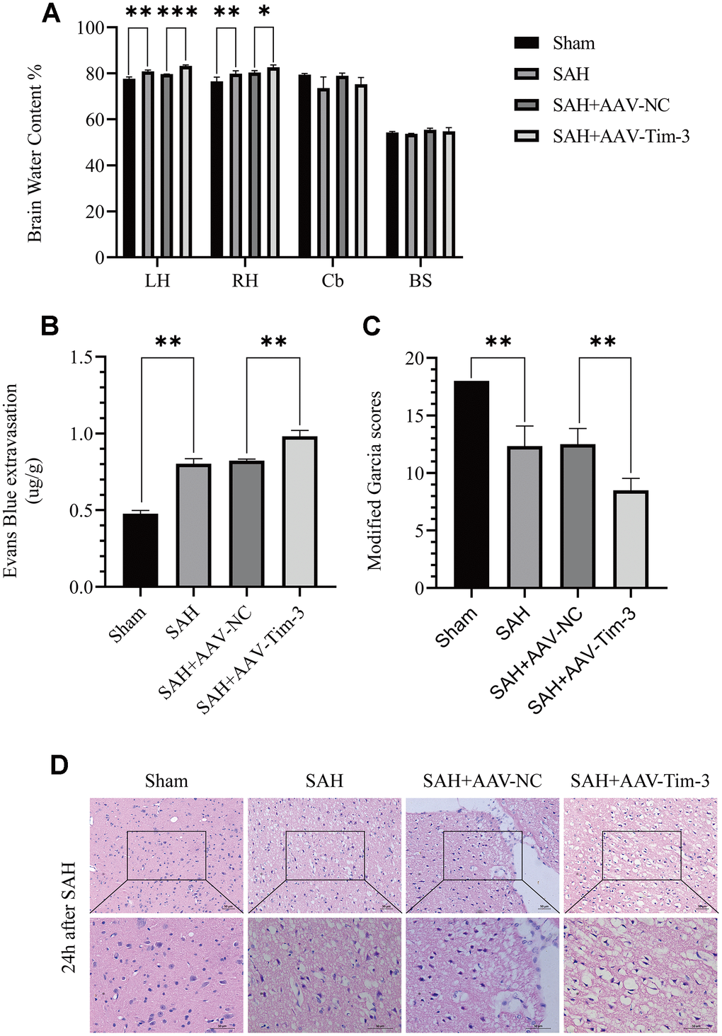 The effect of AAV-Tim-3 on brain edema, BBB disruption, and neurological function after SAH. AAV-Tim-3 treatment significantly increased brain water content (BWC) (A) and Evans Blue dye extravasation (B) at 24 h post-SAH and exacerbated neurological deficits (C) (n = 6/group). Representative images of H&E staining (D) showing alterations in lesion volume after AAV-Tim-3 treatment. Data are expressed as mean ± SD. *p 