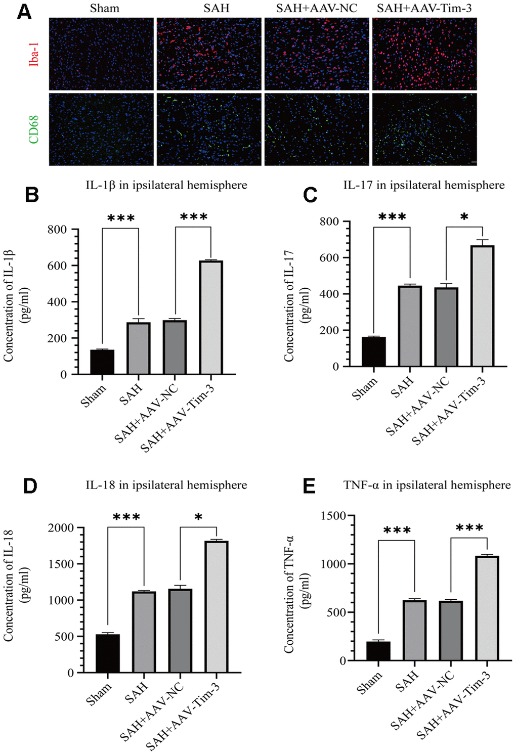 AAV-Tim-3 treatment stimulated microglial activation and upregulated production of the inflammatory cytokines IL-1β, IL-17, IL-18, and TNF-α at 24 post-SAH. Representative images of Iba1- and CD68-positive cells in the sham, SAH, SAH+AAV-NC, and SAH+AAV-Tim-3 groups (A). AAV-Tim-3 treatment increased the expression of the pro-inflammatory cytokines, IL-1β (B), IL-17 (C), and IL-18 (D), TNF-α (E) (n = 6 in each group). Data are expressed as mean ± SD. *p 