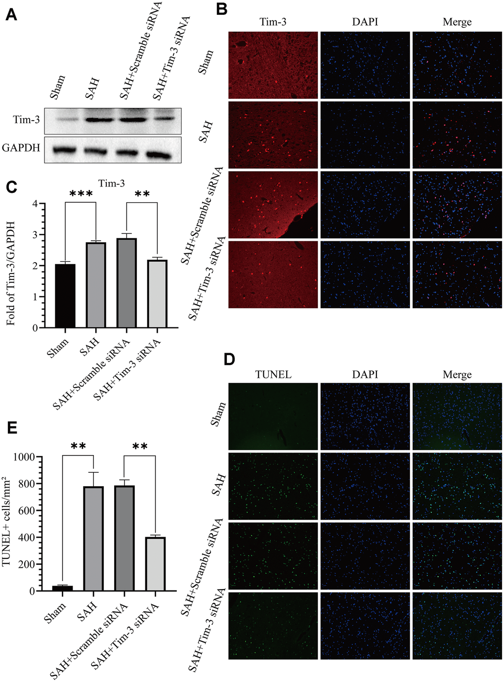 Effects of Tim-3 knockdown on Tim-3 protein levels and neurocyte apoptosis after SAH. Western blotting showing that Tim-3 siRNA significantly decreased the expression of Tim-3 (A) as assessed by quantitative analysis (B). Immunofluorescence staining also verified that Tim-3 siRNA significantly decreased Tim-3expression (C). Representative TUNEL staining images (D) and quantitative analysis of TUNEL-positive cells (E) in the ipsilateral cortex after SAH with Tim-3 siRNA or scramble siRNA treatment (n = 6 in each group). Data are expressed as mean ± SD. **p 
