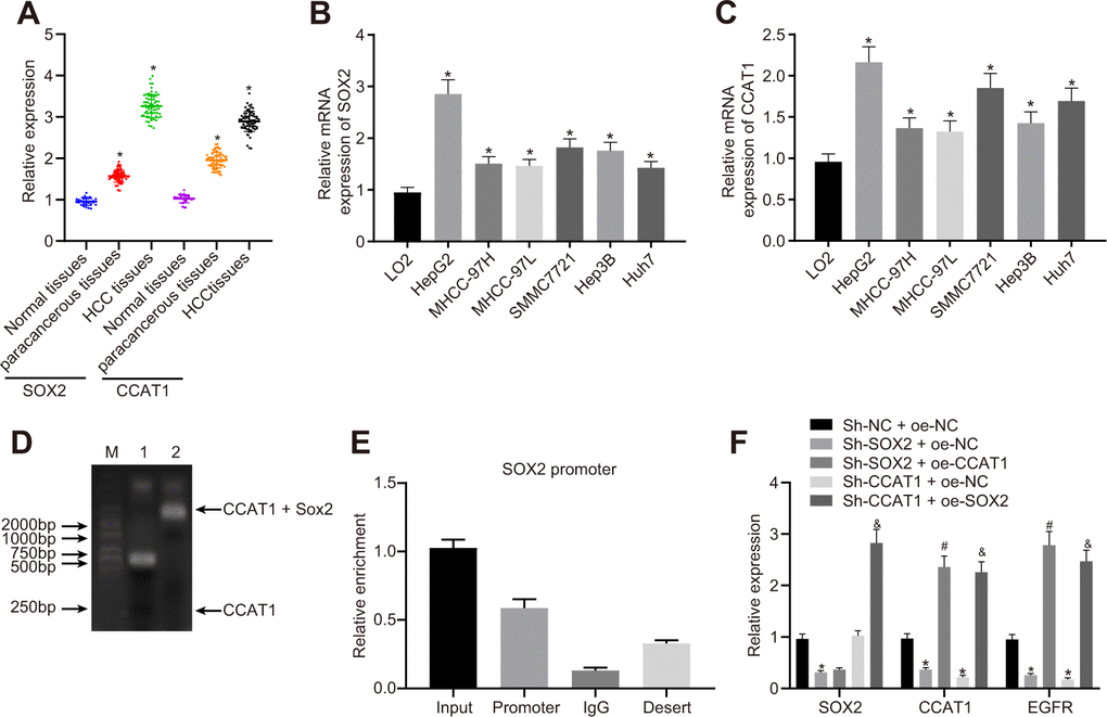 SOX2-mediated lncRNA CCAT1 promotes EGFR expression in HepG2 cells. (A) SOX2 and CCAT1 expression in normal liver (n = 28), para-cancerous (n = 68) and HCC tissues (n = 68) detected by RT-qPCR normalized to β-actin. (B) SOX2 mRNA expression in human HCC cell lines detected by RT-qPCR. (C) CCAT1 expression in human HCC cell lines detected by RT-qPCR. (D) Interaction of SOX2 with CCAT1 in HepG2 cell line detected using EMSA. (E) ChIP-qPCR results of the binding of SOX2 to CCAT1 promoter region in HepG2 cell line. (F) SOX2 expression and CCAT1 and EGFR mRNA expression after alteration of SOX2 and CCAT1 in HepG2 cells detected by RT-qPCR. * p vs. normal liver cell, LO2 or HepG2 treated with sh-NC + oe-NC. # p vs. HepG2 treated with sh-SOX2 + oe-NC. & p vs. HepG2 treated with sh-SOX2 + oe-NC. Data are expressed as mean ± standard deviation. Data comparisons among multiple groups were performed by one-way ANOVA and Tukey’s post hoc test.