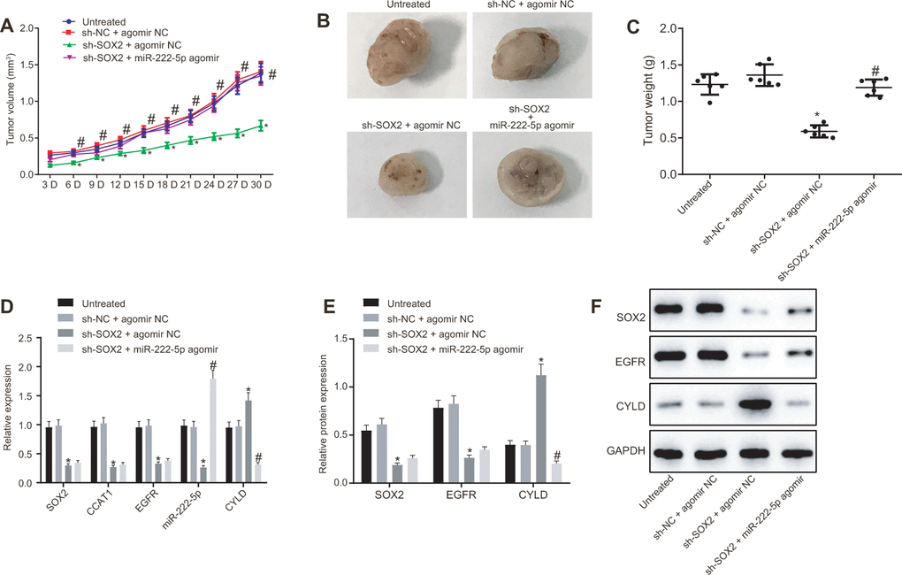 SOX2 silencing represses tumor growth in mice with HCC by activating CCAT1, EGFR, miR-222-5p and by downregulating CYLD. HepG2 cells expressing sh-SOX2, miR-222-5p agomir or corresponding controls (sh-NC or agomir-NC) were administrated subcutaneously to nude mice for developing in vivo tumor model. (A) Tumor growth rate in nude mice. (B) Representative images showing tumor mass collected from nude mice at day 30. (C) Tumor weights in nude mice. (D) mRNA expression of SOX2, EGFR and CYLD and CCAT1 and miR-222-5p expression in nude mice xenografts determined by RT-qPCR normalized to U6 and β-actin. (E, F) Protein expression of SOX2, EGFR and CYLD in nude mice xenografts determined by western blot analysis normalized to GAPDH. n = 6/group. * p vs. untreated mice; # p vs. mice treated with HepG2 cells expressing sh-SOX2 + agomir NC. Data were expressed as mean ± standard deviation. Data from multiple groups were compared by one-way ANOVA and Tukey’s post hoc test. Data were compared between groups at different time points by repeated measures ANOVA and Bonferroni post hoc testing.