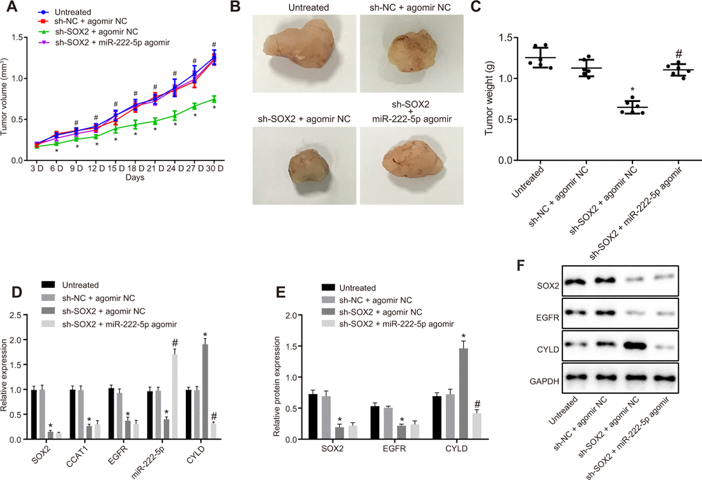 Loss of SOX2 inhibits tumor growth in mice with HCC by activating CCAT1, EGFR, miR-222-5p and downregulating CYLD. Huh7 cells expressing sh-SOX2, miR-222-5p agomir or corresponding controls (sh-NC or agomir-NC) were administrated subcutaneously to nude mice for developing the in vivo tumor model. (A) Tumor growth rate in nude mice presented as tumor volume. (B) Representative images showing tumor mass collected from nude mice at day 30. (C) Terminal tumor weights in nude mice. (D) mRNA expression of SOX2, EGFR and CYLD and CCAT1 and miR-222-5p expression in nude mice xenografts determined by RT-qPCR normalized to U6 and β-actin. (E, F) Protein expression of SOX2, EGFR and CYLD in nude mice xenografts determined by western blot analysis normalized to GAPDH. n = 6/group. * p vs. untreated mice; # p vs. mice treated with Huh7 cells expressing sh-SOX2 + agomir NC. Data were expressed as mean ± standard deviation. Data from multiple groups were compared by one-way ANOVA and Tukey’s post hoc test. Data were compared between groups at different time points by repeated measures ANOVA and Bonferroni’s post hoc testing.