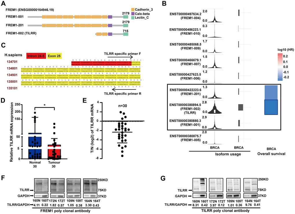 TILRR, the FREM1 isoform 2 transcript, is clinically relevant in breast cancer. (A) The three FREM1 isoforms. (B) TILRR, the gene encoding isoform 2, shows convincing cancer specificity with strong usage and significantly low hazard ratio. (C) TILRR-specific primer of human DNA. (D, E) TILRR expression levels were analyzed by Q-PCR in paired normal and tumor tissues (*P P P F, G) TILRR immunoblotting (indicated by the FREM1 or TILRR antibody) in paired normal and tumor tissues. The band intensities are normalized to GAPDH.