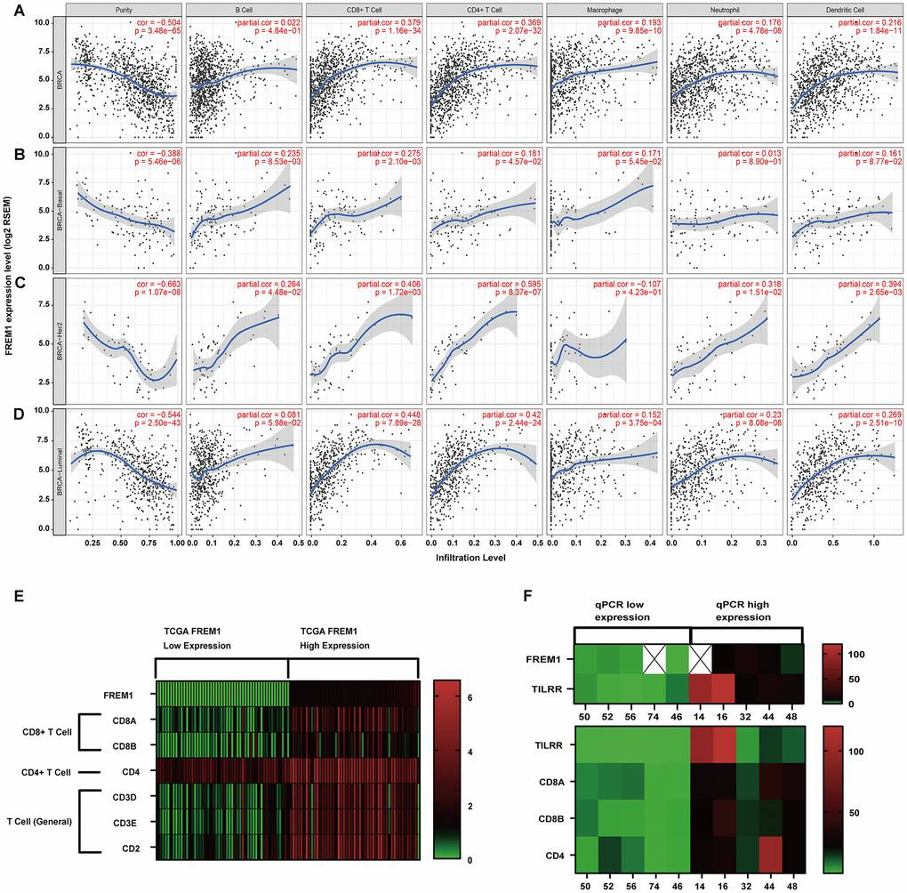 Correlation of FREM1 expression with immune infiltration level in the subtypes of breast cancer. (A) FREM1 expression is negatively related to tumor purity and has significant positive correlations with infiltrating levels of B cells, CD8+ T cells, CD4+ T cells, macrophages, neutrophils and dendritic cells in BRCA. (B) FREM1 expression is negatively related to tumor purity and has positive correlations with infiltrating levels of B cells and CD8+ T cells, but not CD4+ T cells, macrophages, neutrophils and dendritic cells in BRCA-Basal. (C) FREM1 expression is significantly negatively related to tumor purity and has significant positive correlations with infiltrating levels of CD8+ T cells, CD4+ T cells and dendritic cells, but not B cells, macrophages and neutrophils in BRCA-HER2. (D) FREM1 expression is negatively related to tumor purity and has significant positive correlations with infiltrating levels of CD8+ T cells, CD4+ T cells, macrophages, neutrophils and dendritic cells, but not B cells in BRCA-Luminal. (E) The top 50 highest TILRR-expressing and top 50 lowest TILRR-expressing tumor tissue samples were selected (TCGA database) to analyze the expression of marker genes in CD8+, CD4+ and T cells (general). (F) CD8A, CD8B and CD4 expression levels were analyzed by Q-PCR in the 5 highest TILRR expressing and the 5 lowest TILRR expressions samples.