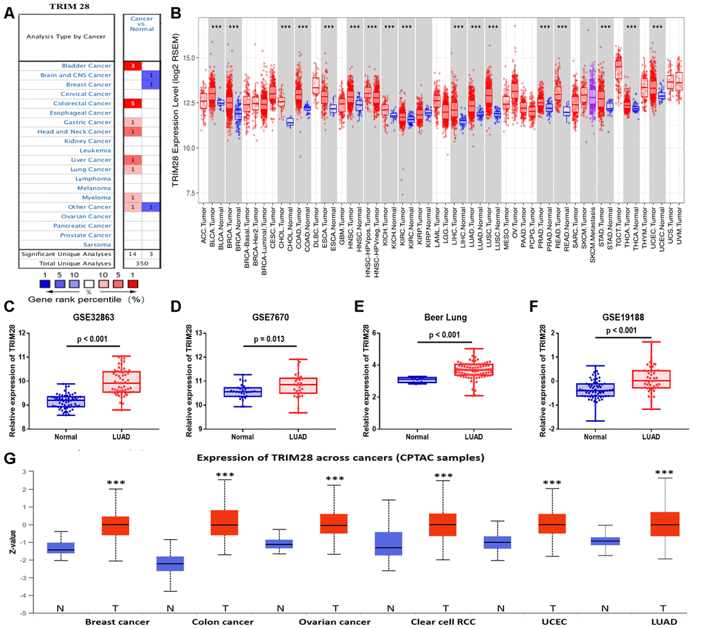 TRIM28 levels in different human cancer types. (A) Increased or reduced TRIM28 levels in different cancers compared with normal tissues in the Oncomine database. (B) Human TRIM28 levels in different tumor types from TCGA were determined using TIMER. (C–F) The significant increase in TRIM28 expression in LUAD was further validated in GSE32863 (C), GSE7670 (D), the Beer Lung dataset (E) and GSE19188 (F). (G) The protein expression of TRIM28 in various cancer tissues was detected using the UALCAN cancer database (*p 