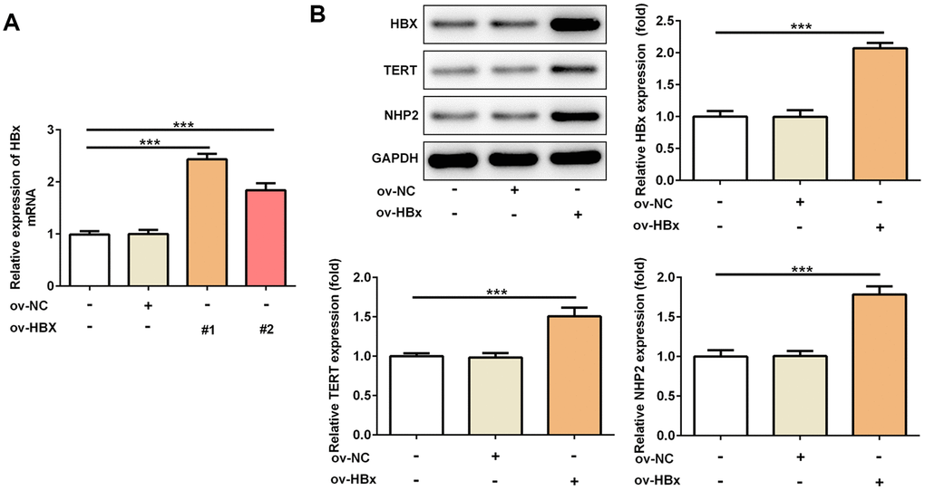 Overexpression of HBx in PLC/PRF5 hepatoma cells increases TERT and NHP2 expression. (A) The HBx mRNA expression was determined after PLC/PRF5 cells were transfected with ov-NC, ov-HBx-1 or ov-HBx-2 plasmids. (B) The protein expression of HBx, TERT and NHP2 was measured in the absence or presence of HBx stable expression. Ov: overexpression, NC: negative control, HBx: Hepatitis B virus X, TERT: telomerase reverse transcriptase. ***P