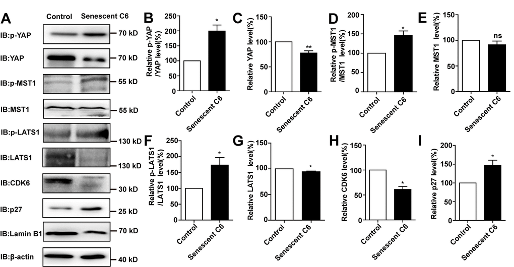 D-gal induced senescence of GBM cells by inactivating YAP-CDK6 pathway in a Hippo pathway dependent manner. (A) Western blot detected the protein expression of p-YAP, YAP, p-MST1, MST1, p-LATS1, LATS1, CDK6, p27kip1, and Lamin B1 in control and senescent C6 cells (treated with 222 mM D-gal for 8 d). (B–I) Quantification of protein levels of p-YAP/YAP, YAP, p-MST1/MST1, MST1, p-LATS1/LATS1, LATS1, CDK6 and p27kip1 (n=3) level as shown in (A). Data shown are mean ± s.e.m. *P **P .