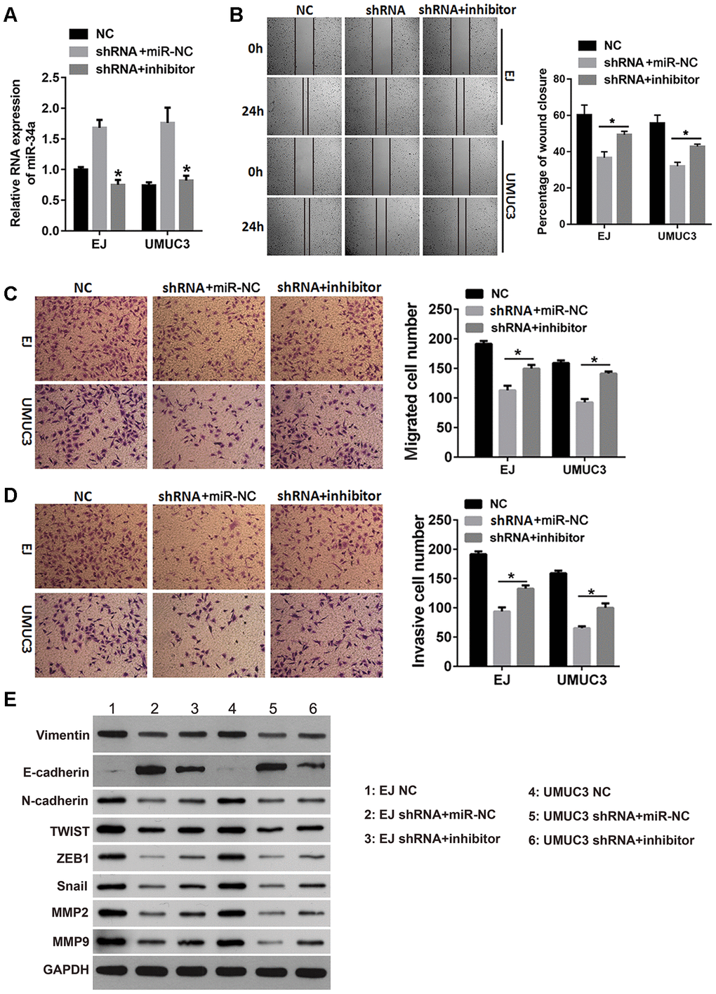 The miR-34a inhibitor reduced the effects of DNMT3B knockdown on migration, invasion, and EMT. The shRNA groups of EJ and UMUC3 cells were transfected with the miR-34a inhibitor (shRNA+inhibitor) or the negative control miRNA (shRNA+miR-NC). The NC groups were used as the control. (A) The miR-34a level was confirmed by qRT-PCR. (B, C) The wound healing assay (B) and the Transwell migration assay (C) were performed to evaluate the migration capability of each group of cells. (D) The Transwell invasion assay was performed to evaluate the invasion capability of each group of cells. (E) The expression of the EMT markers was assessed using western blot analysis, using GAPDH as the loading control. Data were presented as means±SD. *p