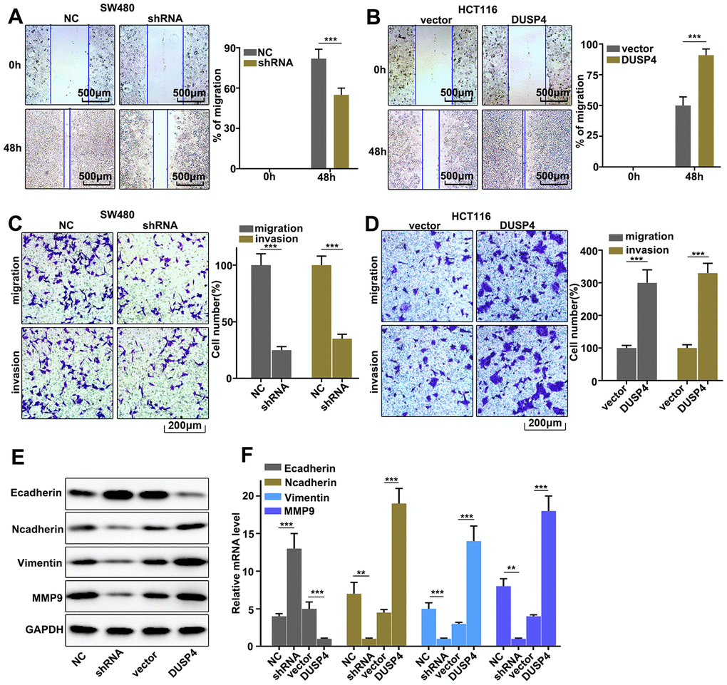 Regulation of USP4 on colorectal cancer cell migration and invasion. (A) Cell scratch test of DUSP4 knockdown-treated SW480 cells. (B) Cell scratch test of DUSP4 overexpression-treated HCT116 cells. (C and D) Cell migration and invasion analysis of DUSP4 knockdown-treated SW480 cells and DUSP4 overexpression-treated HCT116 cells, respectively. (E) Western blot analysis of EMT-related biomarkers expression in DUSP4 knockdown-treated SW480 cells and DUSP4 overexpression-treated HCT116 cells. (F) qRT-PCR analysis of EMT-related biomarkers expression in DUSP4 knockdown-treated SW480 cells and DUSP4 overexpression-treated HCT116 cells. **P