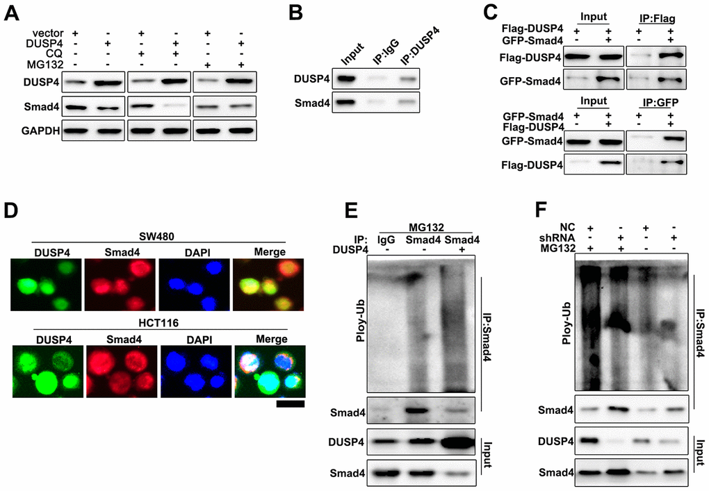 DUSP4 regulated Smad4 expression through ubiquitination. (A) Western blot analysis of DUSP4 and Smad4 expression in DUSP4 overexpression-treated HCT116 cells with CQ and MG132 treatment at different time points. (B) CO-IP analysis of DUSP4 and Smad in SW480 cells. (C) Forward and reverse CO-IP analysis of DUSP4 and Smad in SW480 cells and HCT116 cells. (D) Immunocolocalization analysis of DUSP4 and Smad in SW480 cells and HCT116 cells. (E) Ubiquitination test of DUSP4 and Smad in HCT116 cells. (F) Ubiquitination test of DUSP4 and Smad in SW480 cells. Scale bar: 5 μm.