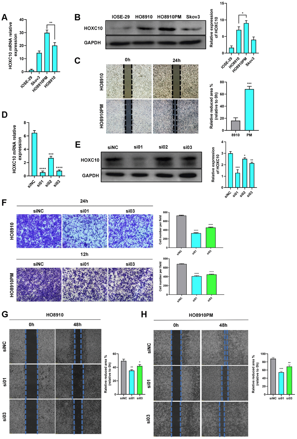 HOXC10 accelerates OC cell migration. (A, B) Relative mRNA and protein expression levels of HOXC10. 8910 vs. PM cells. P=0.0177 (mRNA), P=0.0301 (protein). (C) Comparison of the migration ability of 8910 and PM cells via wound healing assays. P=0.0002. Scale bars, 200 μm. (D, E) Transfection efficiencies of the HOXC10 siRNA products. PF) Transwell assay of 8910 and PM cells transfected with HOXC10 siRNA products No. 1 and No. 3 and the negative control siRNA. 8910 cell graphs, PG, H) Wound healing assay of 8910 and PM cells transfected with HOXC10 siRNA products No. 1 and No. 3 and the negative control siRNA. P=0.0010 and P=0.0167; P=0.0025 and P=0.0097. Scale bars, 200 μm.