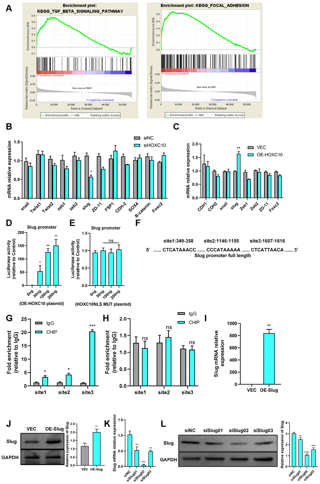 HOXC10 promotes OC cell migration by regulating Slug transcription. (A) The GSEA plot indicates that HOXC10 expression is positively correlated with TGF-β and FAK pathway signatures (OC sample data were downloaded from TCGA, n=379). (B, C) mRNA expression of EMT-related genes in 8910 cells transfected with HOXC10 siRNA, negative control siRNA, the HOXC10 overexpression plasmid, and empty vector. P=0.0257 and P=0.0093. (D) 8910 cells were cotransfected with a plasmid containing the full-length Slug promoter and increasing concentrations of the HOXC10 overexpression plasmid. P=0.0499, P=0.0032 and P=0.0079. (E) 8910 cells were cotransfected with the plasmid containing the full-length Slug promoter and increasing concentrations of the HOXC10 NLS mutation plasmid. P=0.1005, P=0.9559 and P=0.4059. (F) Schematic diagram of three predicted HOXC10 binding sites in the Slug promoter region. (G) Relative fold enrichment for IgG at the three predicted binding sites, as evaluated by ChIP-qPCR. P=0.0162, P=0.0158 and P=0.0003. (H) Relative fold enrichment for IgG at the three predicted binding sites after deletion of the HOXC10 DNA binding sites. P=0.5259, P=0.3579 and P=0.8293. (I, J) Relative mRNA and protein expression levels of Slug in 8910 cells transfected with the Slug overexpression plasmid and empty vector. P=0.0018, P=0.0044. (K–L) Transfection efficiencies of the Slug siRNA products. P=0.0048, P=0.0001, and P=0.0013; P=0.0083, P