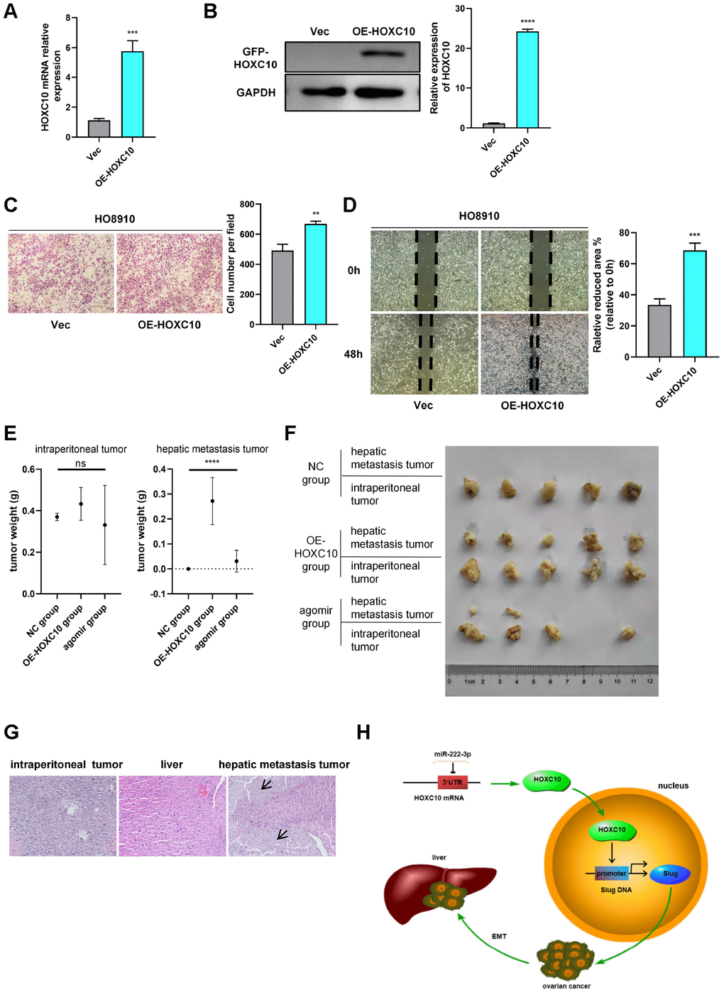 HOXC10 promotes OC metastasis in vivo. (A, B) Relative mRNA and protein expression levels of HOXC10 in VEC and OE-HOXC10 cells. P=0.0003 and PC, D) Transwell and wound healing assays of VEC and OE-HOXC10 cells. P=0.0027 and P=0.0005. Scale bars, 100 μm and 200 μm, respectively. (E) Weights of intraperitoneal tumours and hepatic metastasis tumours from mice in the NC, OE-HOXC10 and agomir groups. (F) Photograph of tumours excised from mice. (G) HE staining of intraperitoneal tumours and livers from mice in the NC, OE-HOXC10 and agomir groups. The black arrows show the regions of tumour metastasis in the livers. Scale bars, 50 μm. (H) A schematic showing that HOXC10 upregulates EMT by directly targeting the downstream Slug gene and that miR-222-3p downregulates HOXC10 by directly binding to its 3’-UTR.