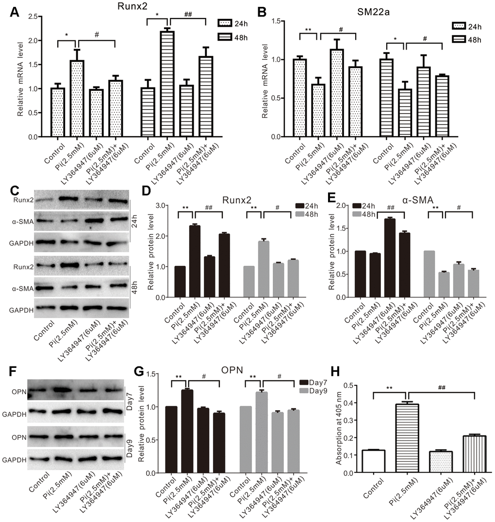 Effects of TGF-β1 on high phosphate-induced calcification markers in VSMCs cells. (A) Real-time PCR assay results show the effect of high phosphate and/or LY364947 on mRNA of Runx2 in VSMCs cells ("*" pB) Real-time PCR assay results show the effect of high phosphate and/or LY364947 on mRNA expression of SM22α in VSMCs cells ("*" pC) Western blot assay results show the effect of high phosphate and/or LY364947 on Runx2 and α-SMA in VSMCs cells; GAPDH was used as a loading control. (D) Quantification results of Western blot assay show the effect of high phosphate and/or LY364947 on Runx2 in VSMCs cells ("**" pE) Quantification results of Western blot assay show the effect of high phosphate and/or LY364947 on α-SMA in VSMCs cells ("**" pF) Western blot assay results show the effect of high phosphate and/or LY364947 on OPN in VSMCs cells; GAPDH was used as a loading control. (G) Quantification results of Western blot assay show the effect of high phosphate and/or LY364947 on OPN in VSMCs cells ("**" pH) Quantitative analysis results of Alizarin Red S staining show the effect of TGF-β1 on mineralization in VSMCs ("**" p