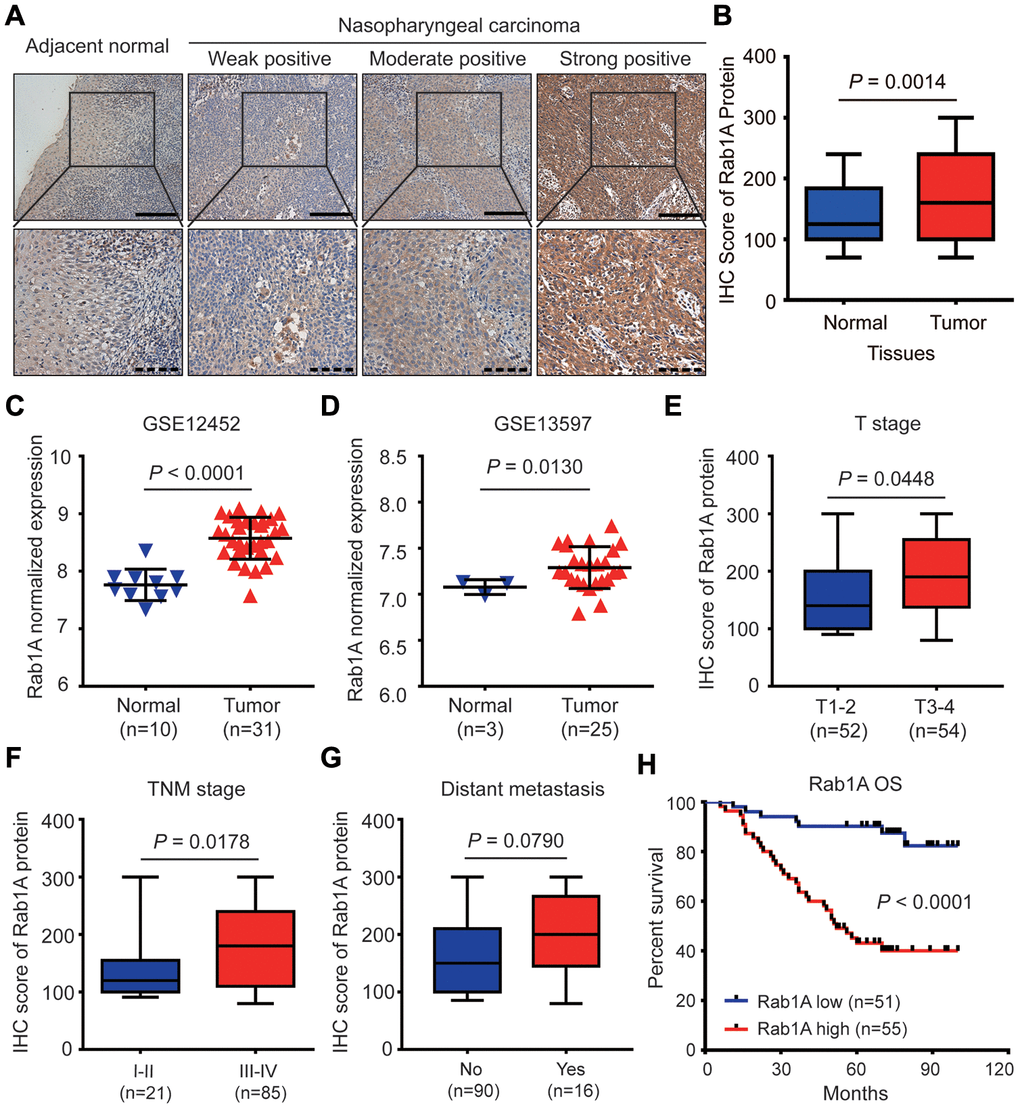 Rab1A is highly expressed in NPC and positively correlates with poor prognosis of NPC patients. (A) Shown are representative immunohistochemistry (IHC) staining of Rab1A in NPC and non-cancerous nasopharyngitis (NP) tissues. Lower panels represent magnified images of boxed area in the corresponding upper panel. The full line and dotted line scale represent 100 μm and 50 μm. (B) Comparsion of Rab1A expression between NPC tissues and NP tissues. The expression of Rab1A mRNA was upregulated in the Gene Expression Omnibus (GEO) database (C) GSE12452 and (D) GSE12597. (E–G) The expression of Rab1A in NPC patients with different T stage, different TNM stage or with/without distant metastasis. (H) Kaplan-Meier survival curve of OS in NPC patients with high (n=55) and low (n=51) levels of Rab1A expression. NPC patients with high expression of Rab1A have shorter OS than patients with low expression (P 