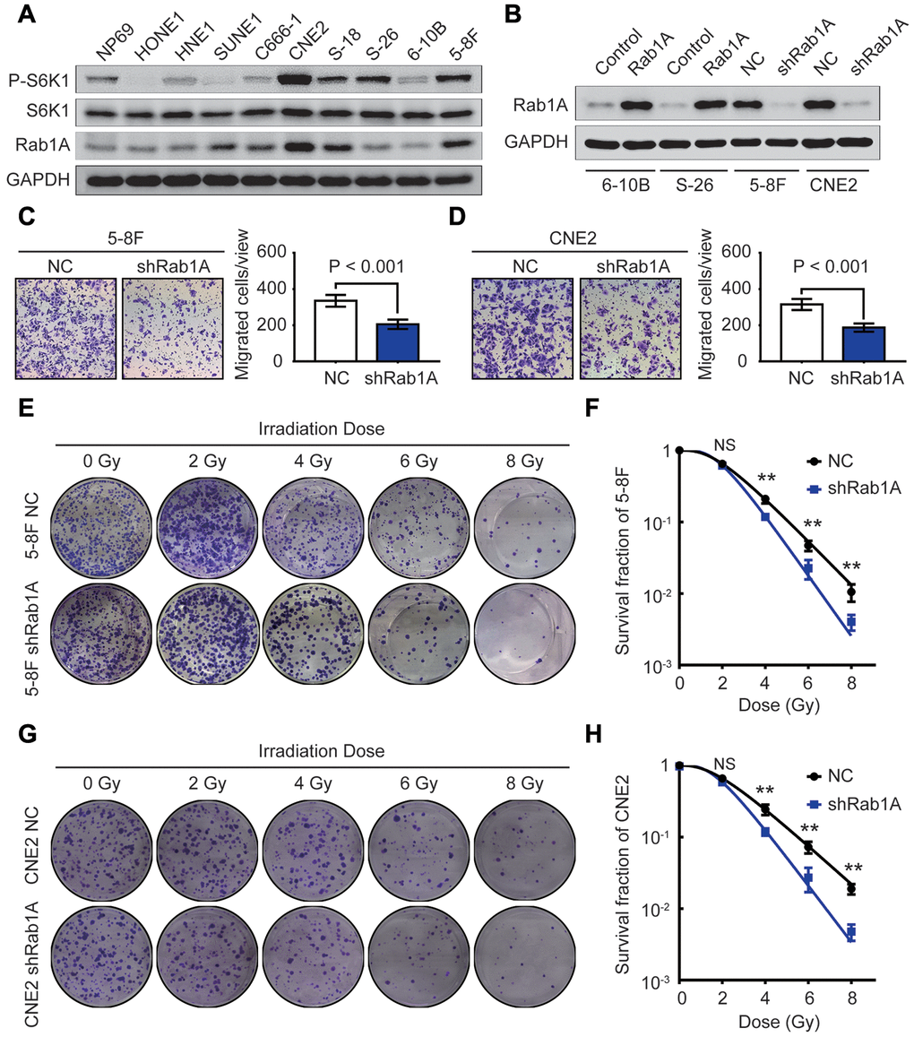 Rab1A knockdown inhibits metastasis and enhances radiosensitivity in NPC cells in vitro. (A) The expression of Rab1A, S6K1 and P-S6K1 proteins in 9 NPC cell lines and one human nasopharyngeal normal epithelium cell line NP69 is detected by western blotting. (B) Immunoblot analysis of Rab1A expression in 6-10B and S-26 cells transfected with Rab1A overexpression vector or 5-8F and CNE2 cells transfected with Rab1A shRNA. GAPDH served as a loading control. (C and D) The migration ability of 5-8F and CNE2 cells with Rab1A knockdown was evaluated by transwell assays. The left panels show representative images of cells that migrated through the PET membrane (magnification 200X). The right panel shows histograms of the data. Results are expressed as mean ± SD of three independent experiments. (E) Representative photos of 5-8F cells stably expressing Rab1A shRNA or a control shRNA cultured for 2 weeks after exposure to irradiation doses of 0, 2, 4, 6, 8 Gy, respectively. (F) Doses survival curve of 5-8F cells was constructed using the linear quadratic model. (G) Representative images of CNE2 cells transfected by Rab1A shRNA or scrambled shRNA (NC) cultured for 14 days after irradiation with the indicated Gy dose. (H) Doses survival curve of CNE2 cells was plotted using the linear quadratic model. Error bars: mean ± SD. **P 