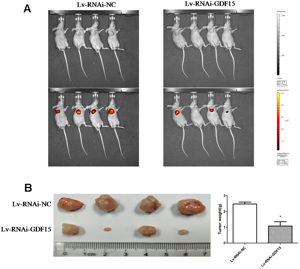 GDF-15 promotes subcutaneous pancreatic cancer cell growth in nude mice. Lv-RNAi-NC and Lv-RNAi-GDF-15 AsPC-1 cells were subcutaneously injected into nude mice. (A) Impact of GDF-15 knockdown on AsPC-1 cells growth following xenotransplantation into nude mice by subcutaneous injection. Cancer cells growth were monitored using the IVIS® Spectrum system (Perkin Elmer, USA). The intensity of red fluorescent signal means the size of tumor cells after proliferation. (B) The tumor growth and mean tumor weights were detected after 30 days of inoculation.