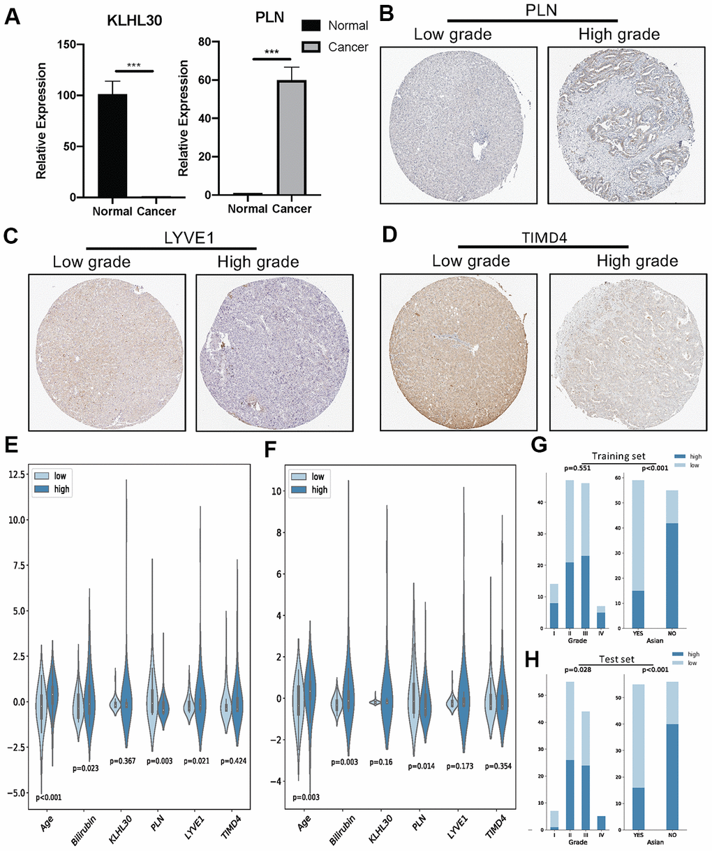 (A) QPCR analysis of KLHL30 and PLN in normal liver cell line and LIHC cell line (n = 3, ***P t test. (B–D) IHC results related to significant genes. (E) Nonparametric test (U test) for continuous variables and risk groups in the training set; P F) U test for continuous variables and risk groups in the test set; P G and H) Chi-square test for discrete variables and risk groups. (G) Training set. (H) Test sets. P 