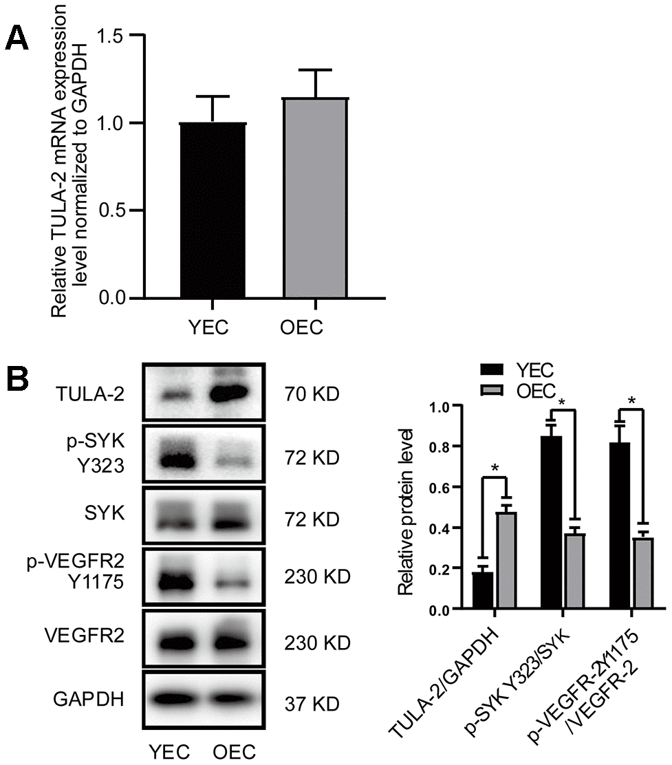 Protein and mRNA expression of TULA-2, SYK Y323 and VEGFR-2 Y1175 in ECs. ECs were incubated under normal culture conditions. (A) RT-qPCR showed no significant change in the mRNA levels of TULA-2 in OECs. (B) Western blot analysis revealed an increase in the protein levels of TULA-2 in OECs, and the phosphorylation levels of SYK Y323 and VEGFR-2 Y1175 were decreased in OECs (*P 