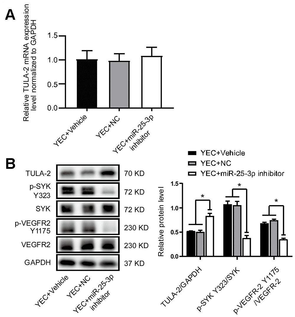 The miR-25-3p inhibitor negatively regulates the angiogenic signaling pathway by reducing angiogenic growth factor expression. (A) RT-qPCR showed no significant change in the TULA-2 mRNA level in YECs after transfection with the miR-25-3p inhibitor. (B) Western blot analysis showed that the miR-25-3p inhibitor upregulated the protein level of TULA-2 and downregulated the phosphorylation levels of SYK Y323 and VEGFR-2 Y1175 in YECs (n=3, data are expressed as the mean ± SEM, *P 
