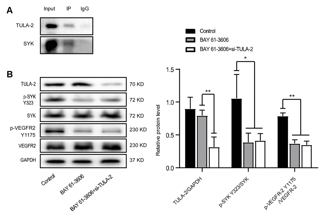 The interaction of TULA-2 and SYK inhibits the phosphorylation of SYK Y323 and VEGFR-2 Y1175. (A) Western blot analysis of the Co-IP experiment showed that SYK immunoprecipitated with anti-TULA-2, SYK and TULA-2, which was visualized by Western blot. (B) Western blot analysis of relative TULA-2, SYK Y323 and VEGFR-2 Y1175 expression in YECs transfected with the control, BAY 61-3606 (SYK inhibitor), and BAY 61-3606 + si-TULA-2. The phosphorylation levels of SYK Y323 and VEGFR-2 Y1175 were decreased in YECs after transfection with BAY 61-3606 or BAY 61-3606 + si-TULA-2 (data are expressed as the mean ± SEM, *P 
