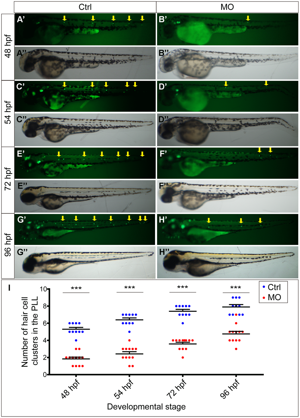 slc4a2b knockdown leads to decreased HC clusters in the posterior lateral line of zebrafish. (A–D) Zebrafish injected with slc4a2b-morpholino (MO) had normal morphology (B’’, D’’, F’’, H’’) but decreased HC clusters in the posterior lateral line (B’, D’, F’, H’) compared to the controls (Ctrl) (A’’, C’’, E’’, G’’ and A’, C’, E’, G’) at different developmental stages. The HC clusters in the posterior lateral line are indicated by yellow arrows. (I) Quantification of the number of HC clusters in the posterior lateral line in slc4a2b-morphants and controls at different developmental stages. ***P 