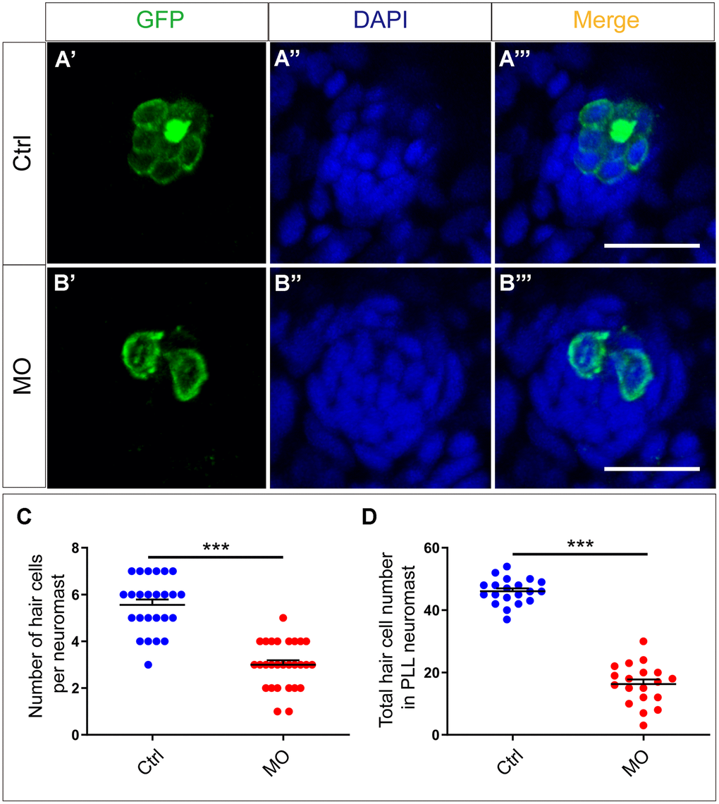 slc4a2b knockdown leads to decreased HCs in the posterior lateral line neuromast of zebrafish. (A, B) slc4a2b-morphants (MO) (B) had fewer HCs in each neuromast compared to controls (A). Tg(Brn3c:mGFP) transgenic zebrafish were used in the analysis, and the cells labeled by GFP represent HCs, while DAPI was used to stain the cell nuclei. (C, D) Quantification of the number of HCs in each neuromast and the total HCs in posterior lateral line neuromasts of the slc4a2b-morphants and controls. Scale bar = 20 μm, *** P 