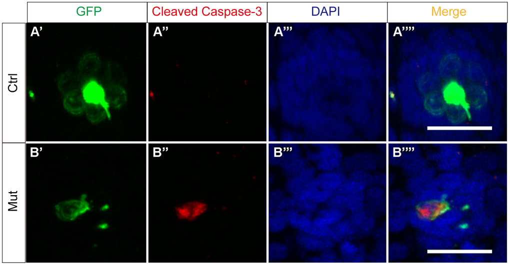 slc4a2b gene mutation leads to HC apoptosis. The control zebrafish, Tg(Brn3c:mGFP) (A), and the mutant zebrafish, Tg(Brn3c:mGFP);slc4a2bmut (B), were used for the apoptosis assay. Here, the anti-cleaved caspase-3 antibody was used to detect the apoptotic cells. Scale bar = 20 μm.