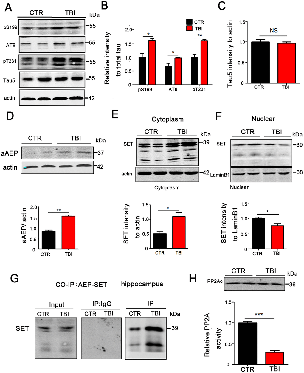 TBI caused tau hyperphosphorylation and cytoplasmic retention of SET accompanied by AEP activation. (A–C) Hippocampal tissues were homogenized, and tau protein levels of pS199, pS202/pT205 (AT8), pT231 were detected by immunoblotting (A, B). Total tau level was measured (C) with actin as loading control. (D) aAEP (molecular weight at 36KD) was measured by immunoblotting. (E, F) We separate cytosolic and nuclear proteins: SET in cytoplasm (E) and in nuclei (F) were measured. (G) The interaction of AEP and SET was evaluated by Co-IP. (H) Hippocampal PP2A level and activity were tested. n=3. p value significance is calculated from a one-way ANOVA, data are represented as mean ± SEM. *p p p vs control group.